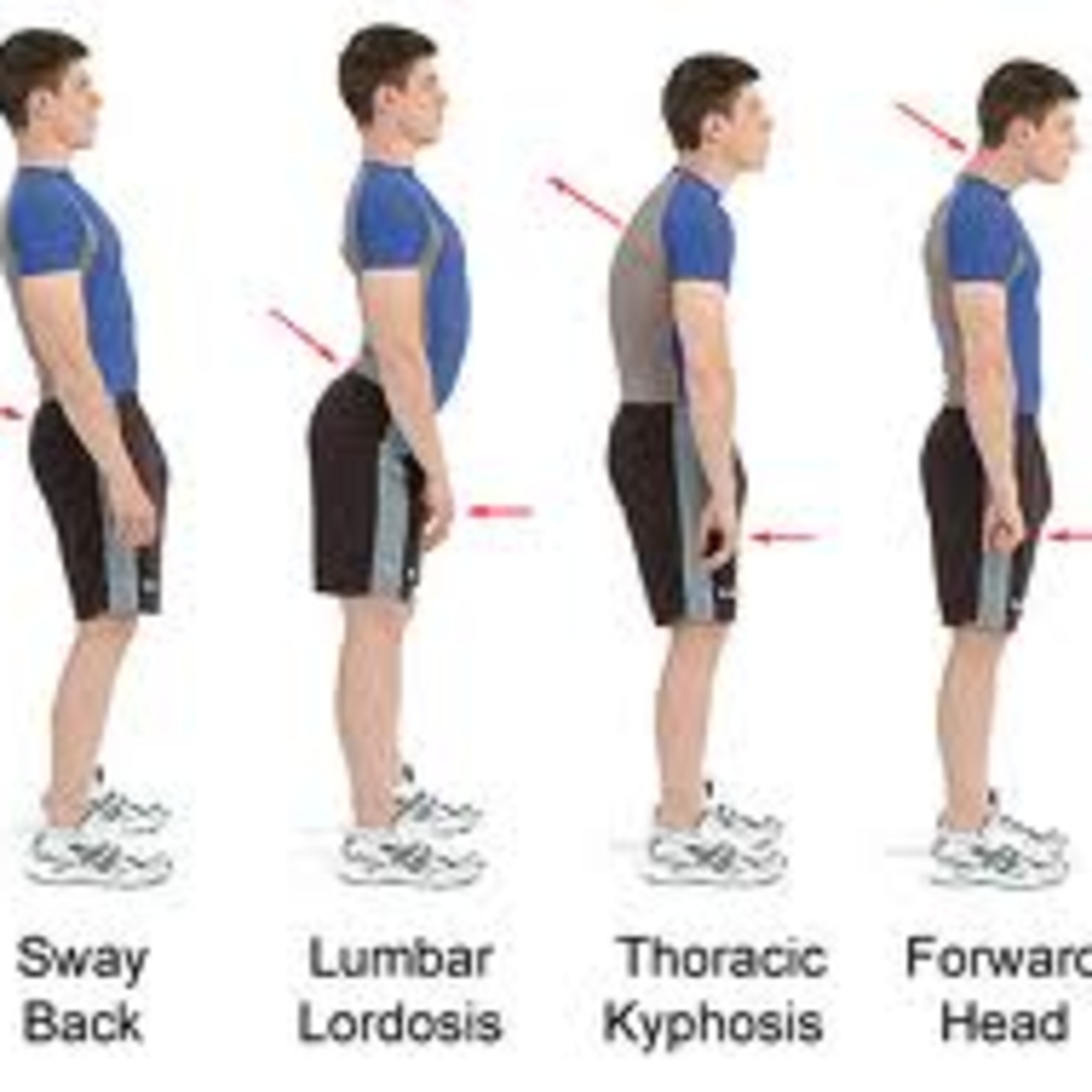 Episode 14 : Posture Types
