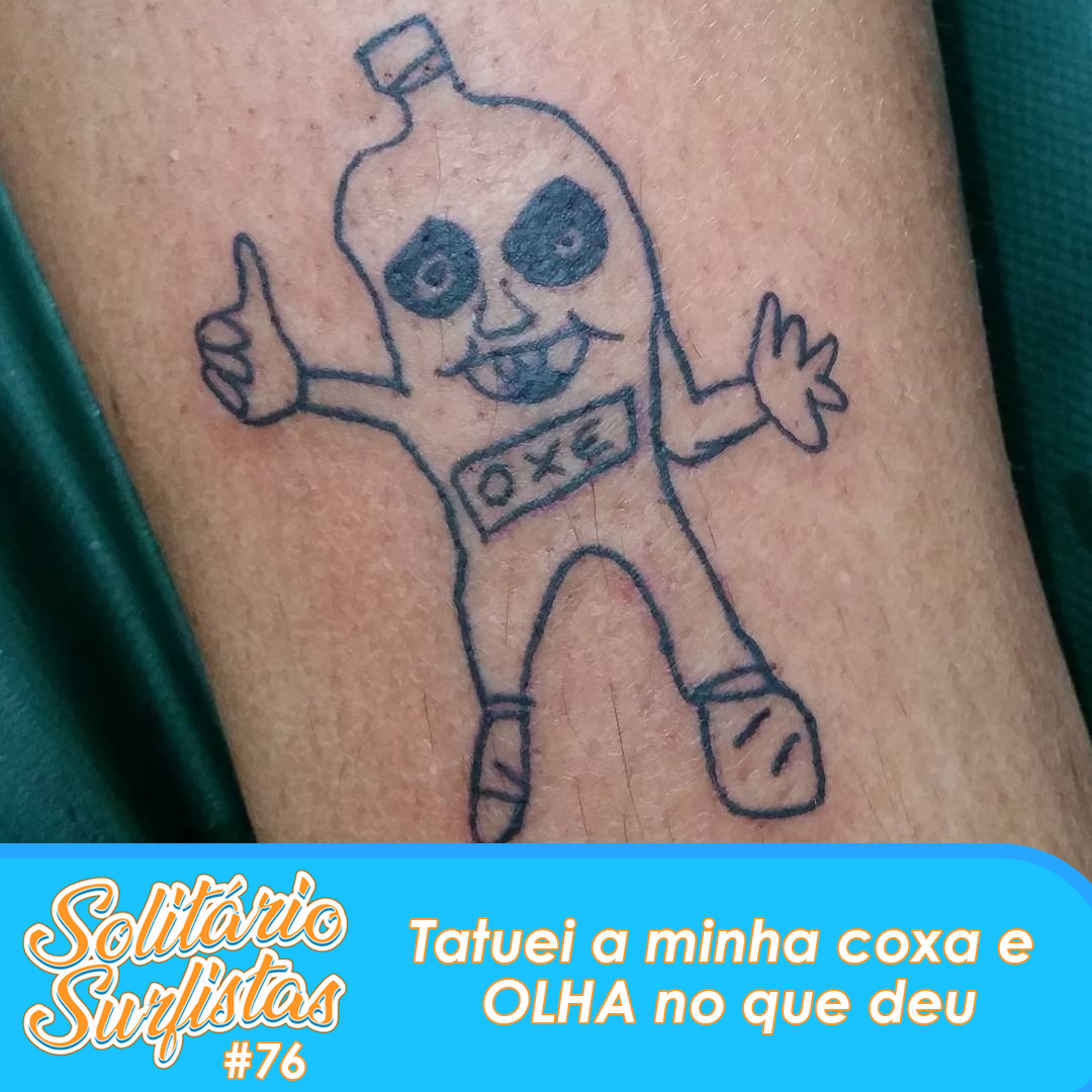 Solitário Surfistas