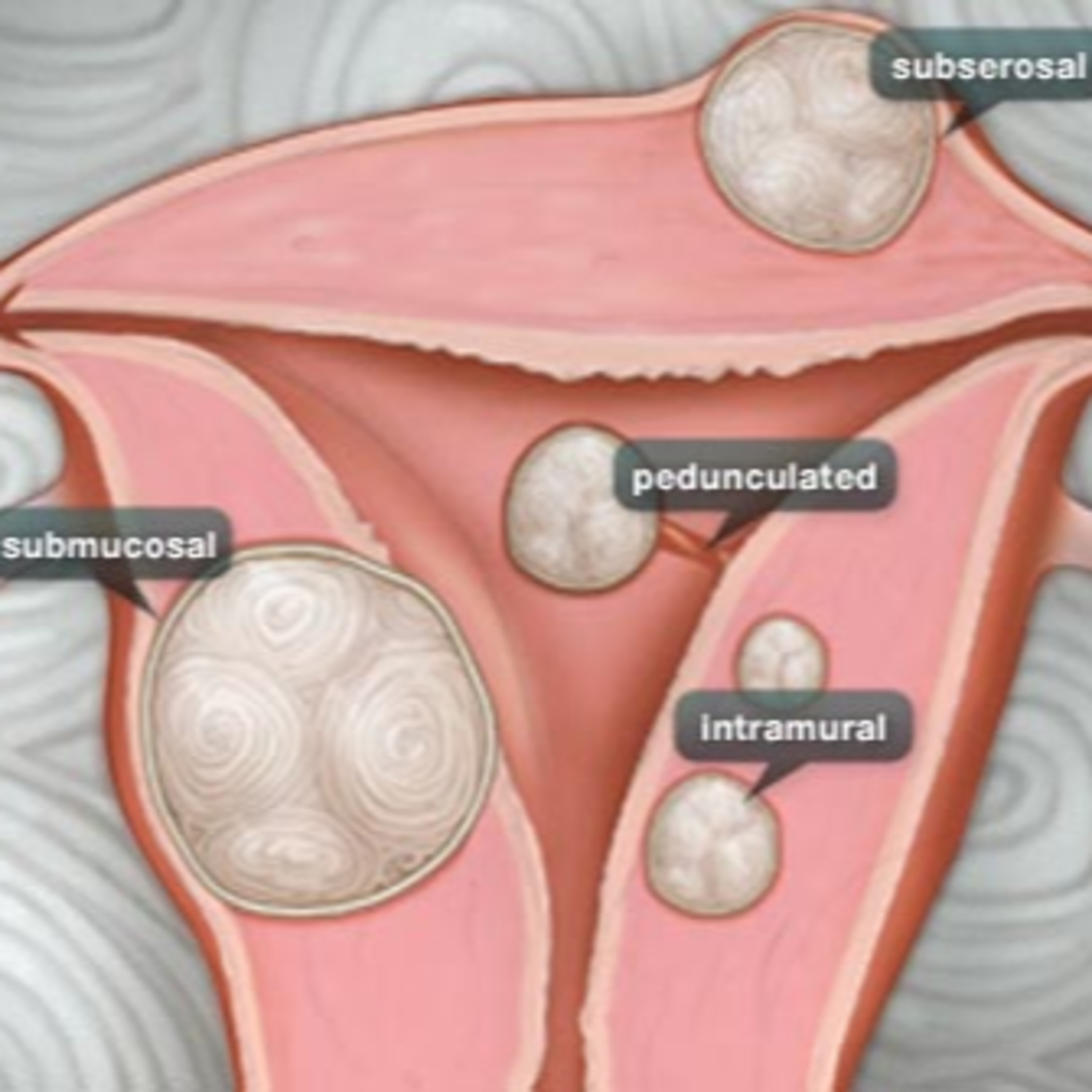 Womens Health Matters