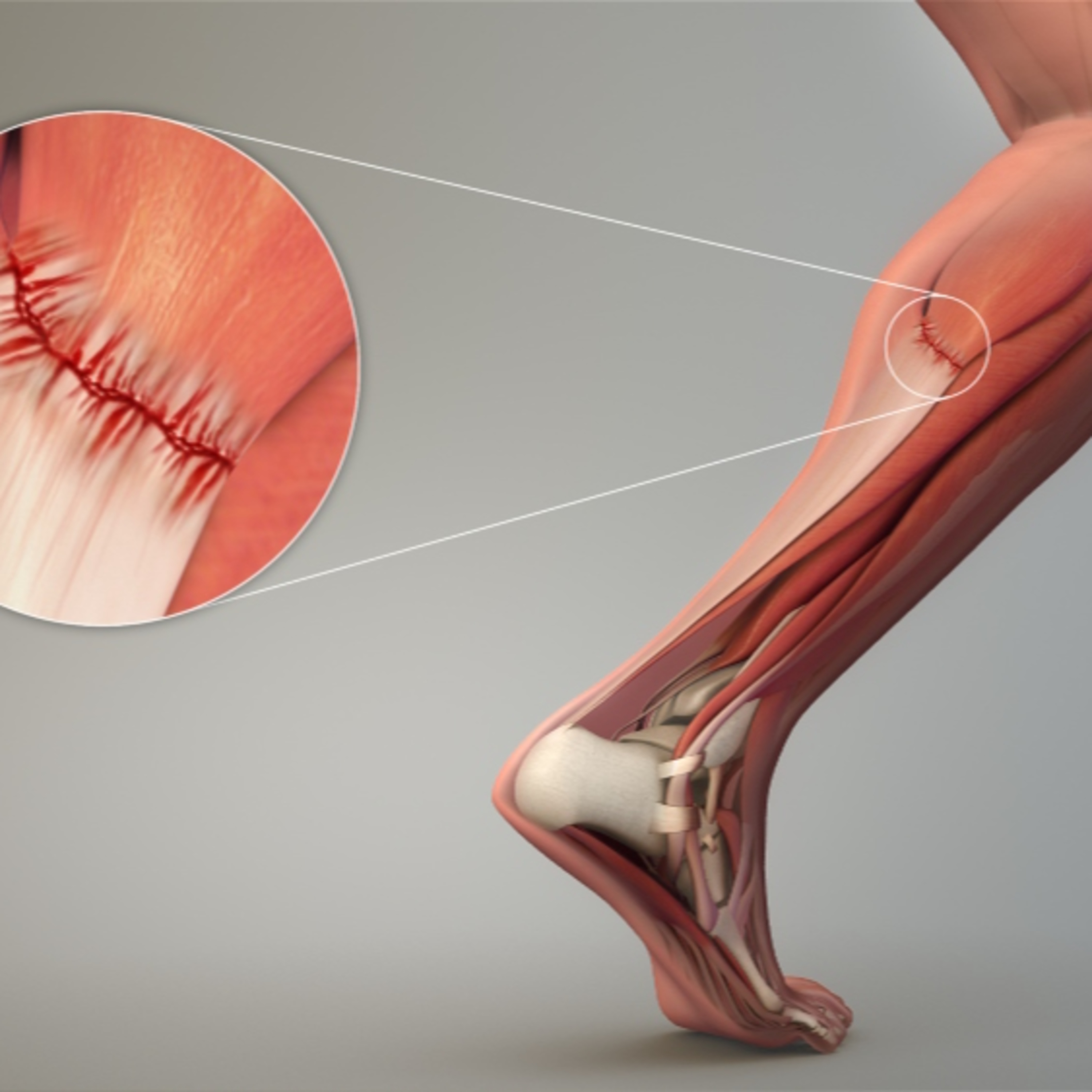 Thomas Gehrmann Colorado Springs