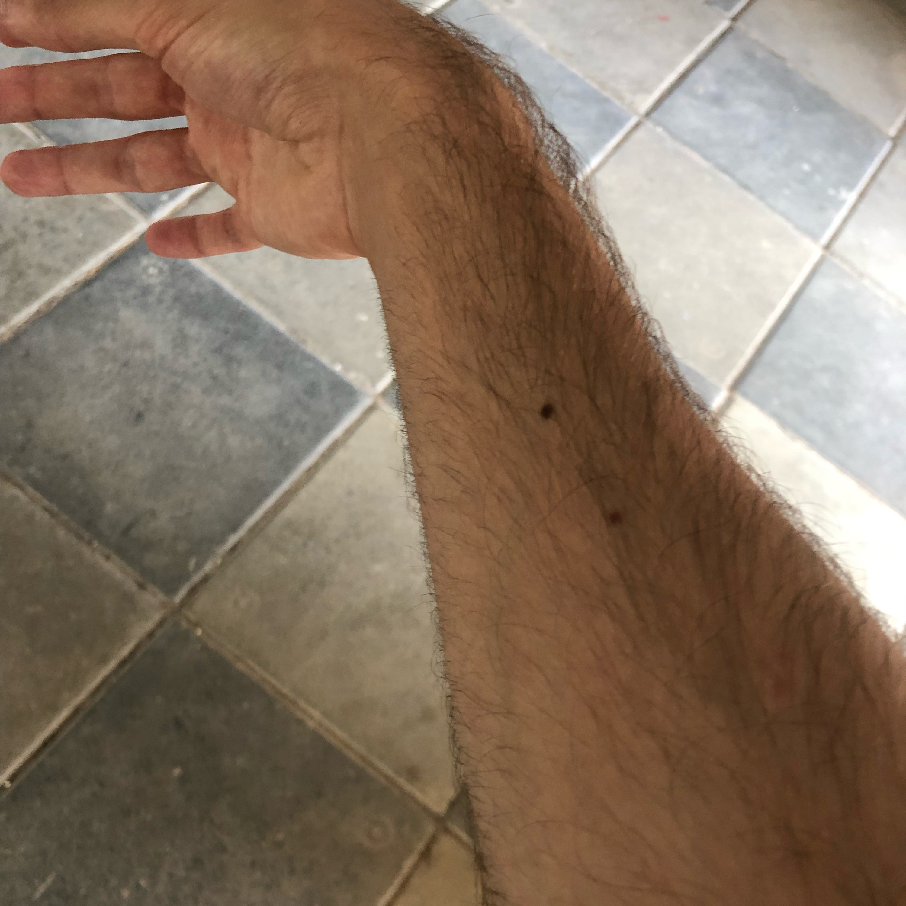 I broke my arm because my brother is an animal.