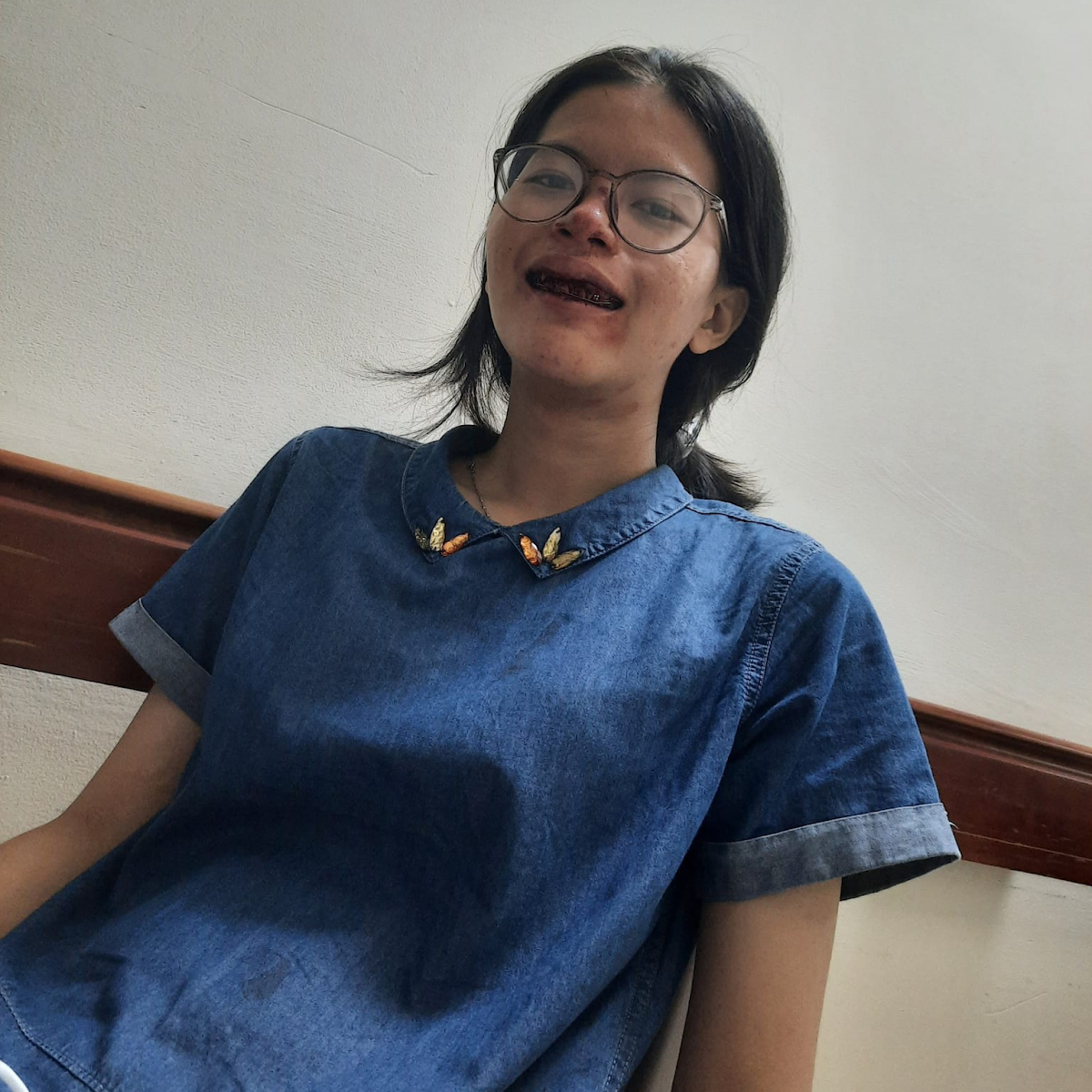 NÓNG: Nữ sinh bị tai nạn gãy hết hàm răng tố hung thủ bỏ trốn, chửi mắng, không chịu trách nhiệm episode artwork