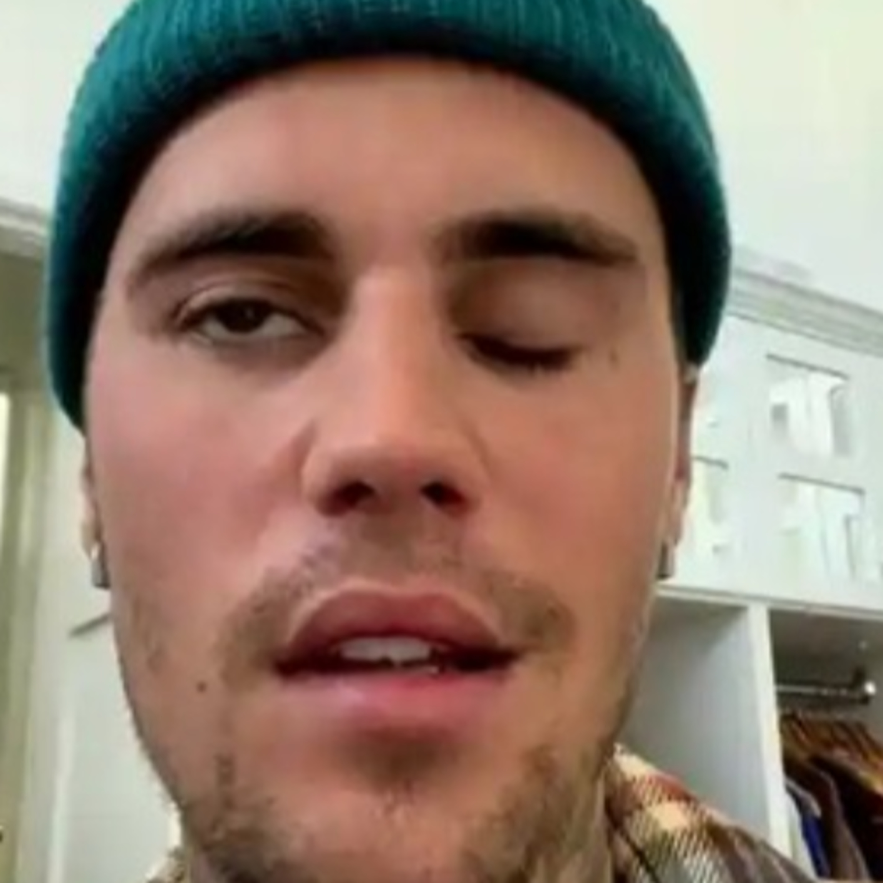 Hailey có hành động gây chỉ trích trong lúc Justin Bieber vật lộn với bệnh hiếm, liệt nửa mặt episode artwork