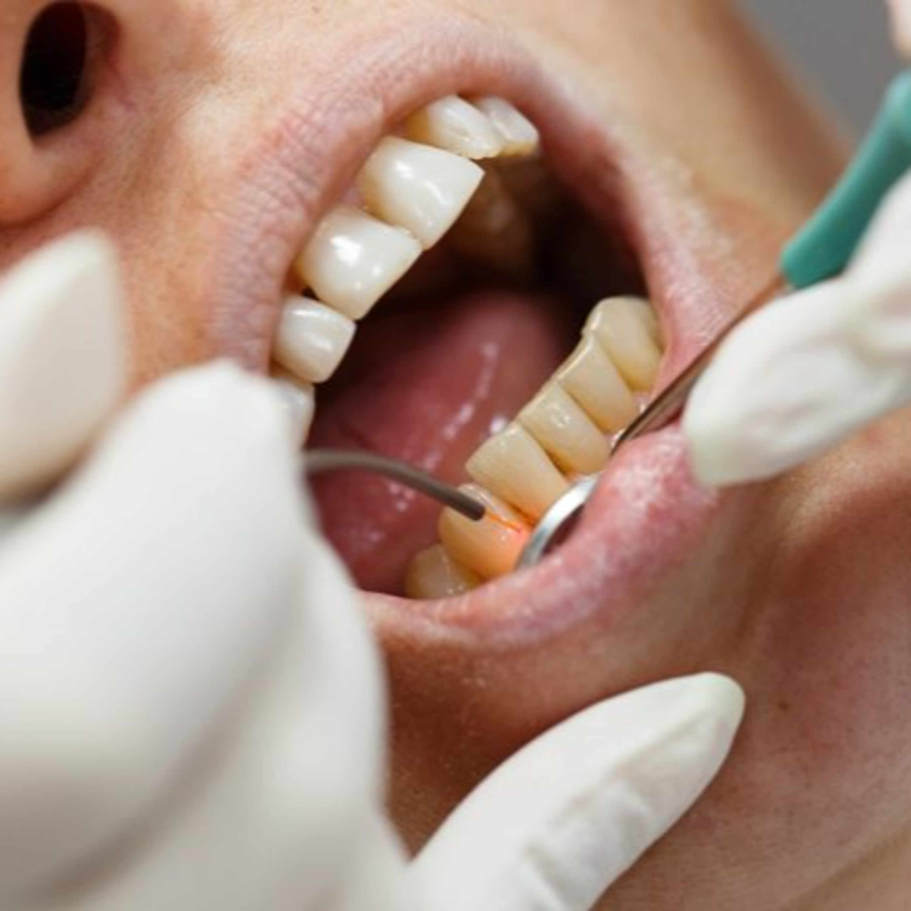 Today\'s RDH Dental Hygiene Podcast