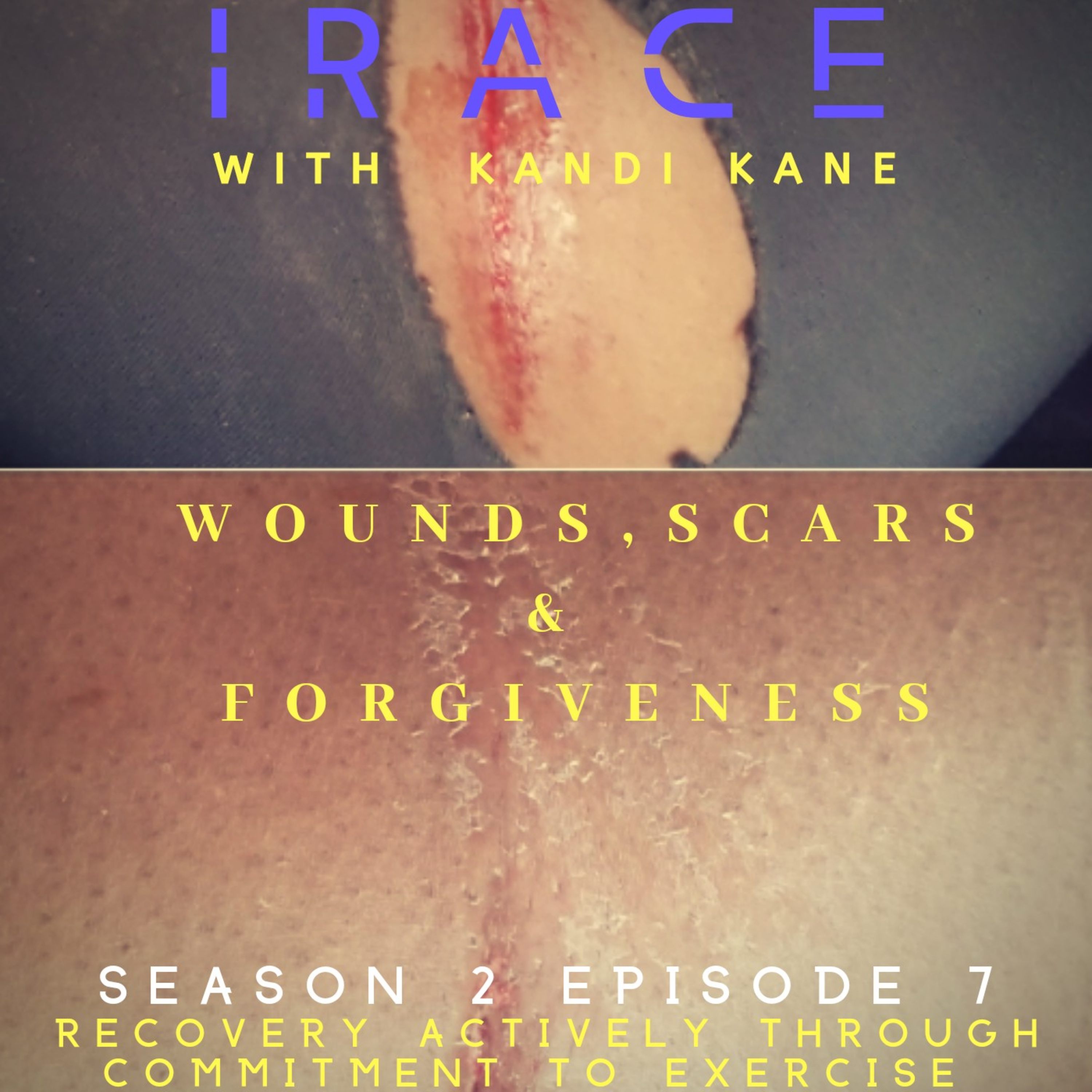 IRACE