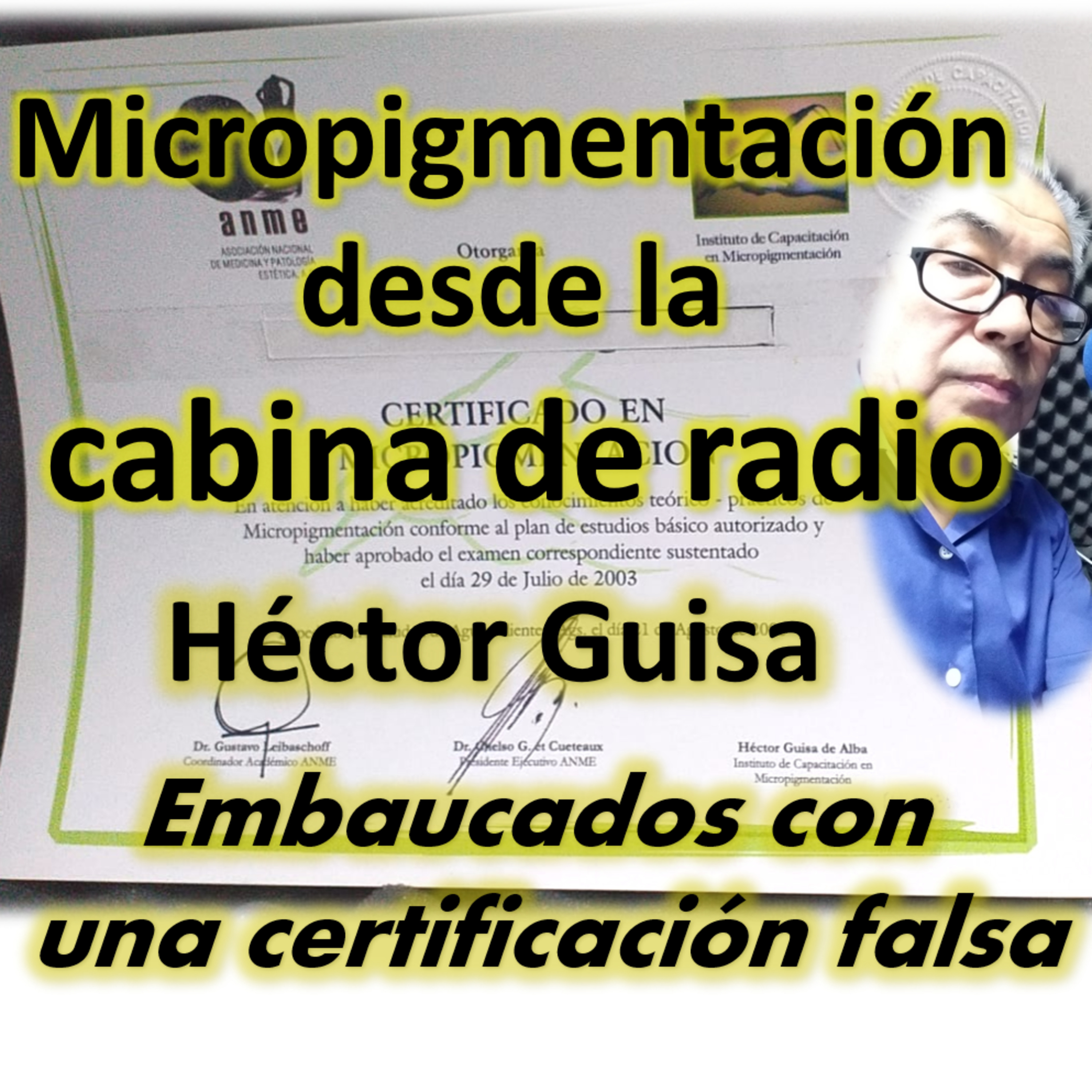 MICROPIGMENTACIÓN DESDE LA CABINA DE RADIO