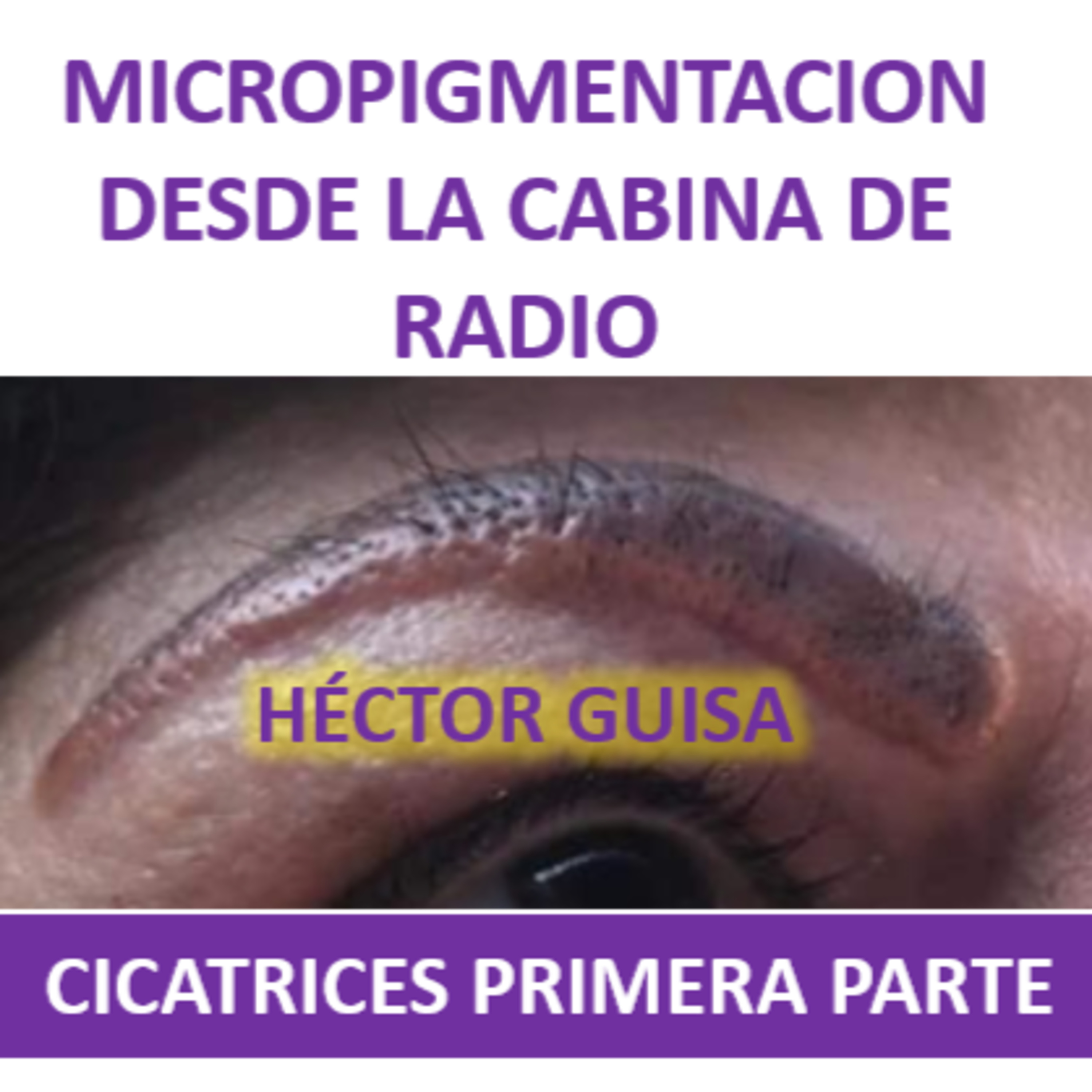 MICROPIGMENTACIÓN DESDE LA CABINA DE RADIO
