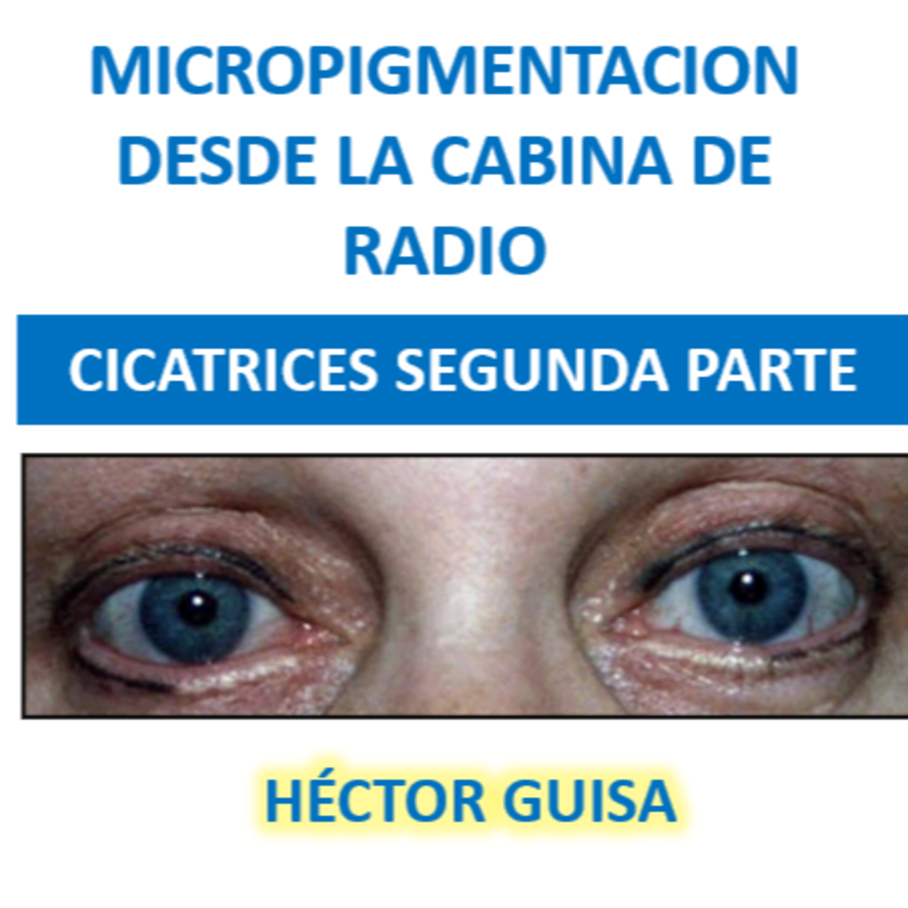 MICROPIGMENTACIÓN DESDE LA CABINA DE RADIO