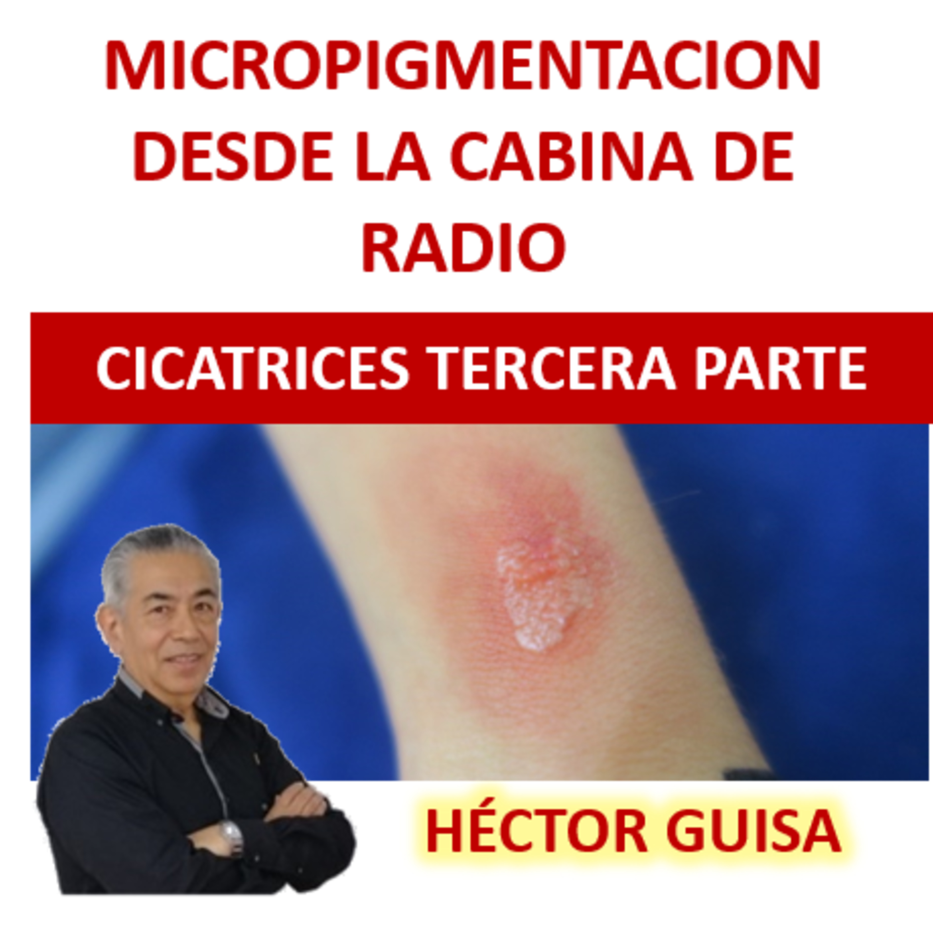 MICROPIGMENTACIÓN DESDE LA CABINA DE RADIO