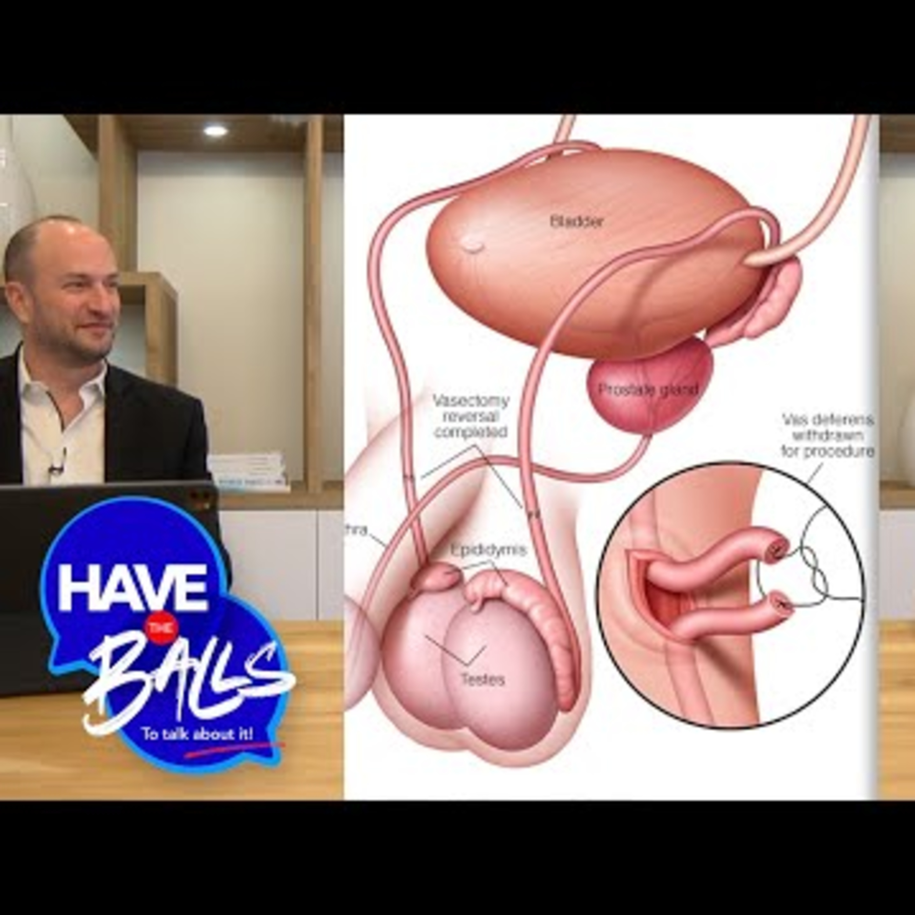 Vasectomy Reversal Procedure episode artwork