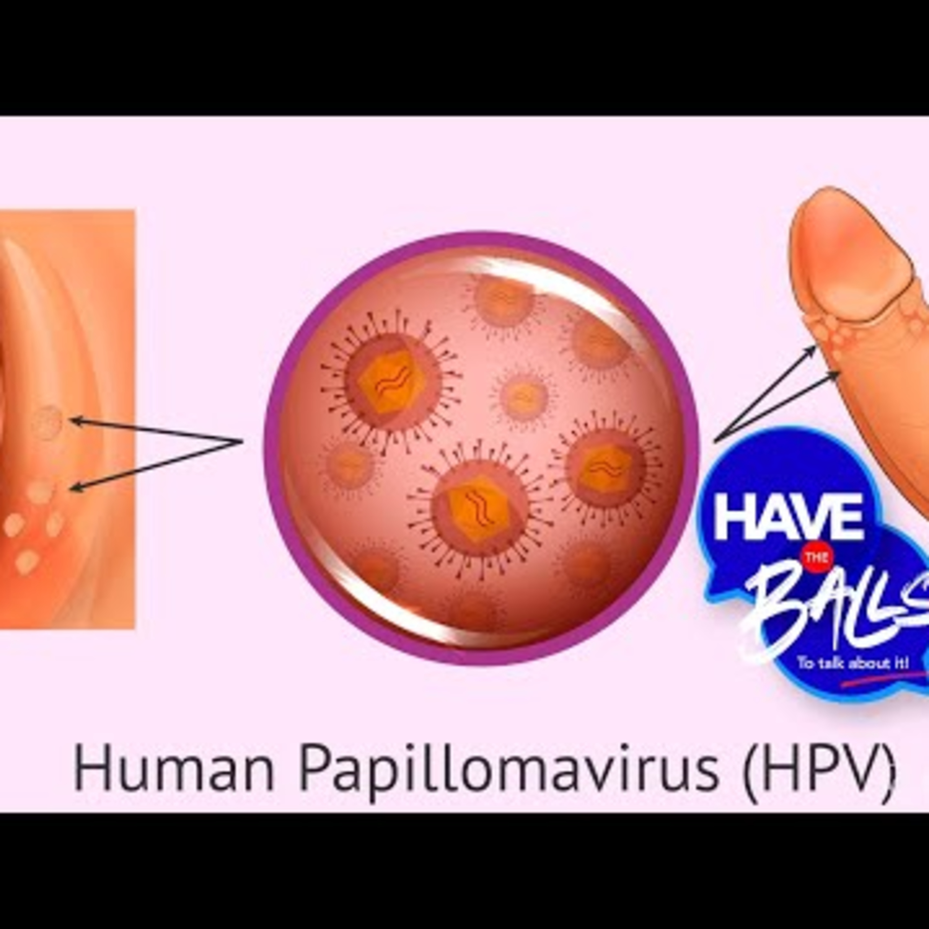 Genital Warts episode artwork
