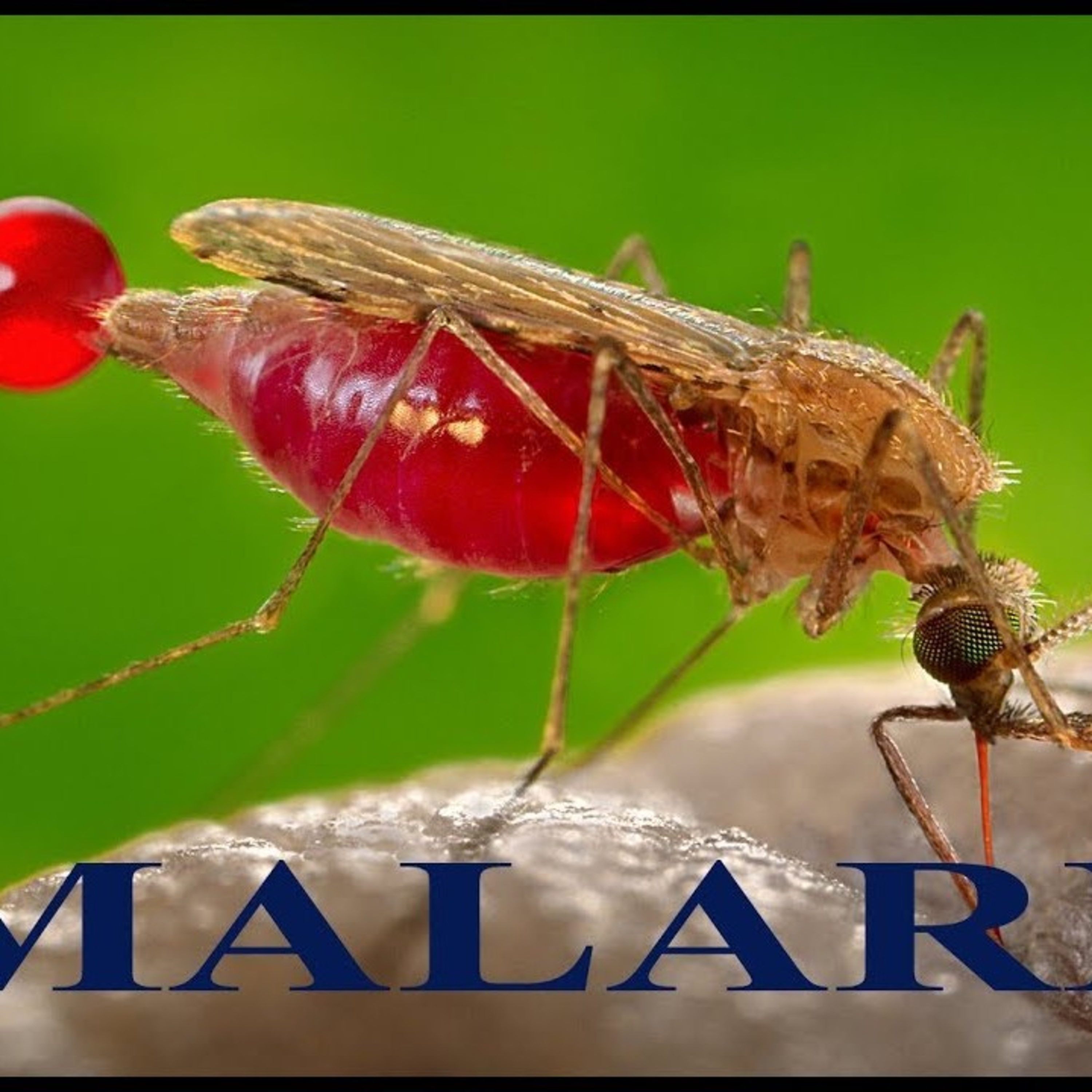 Rwanda Health Mag Podcast🇷🇼