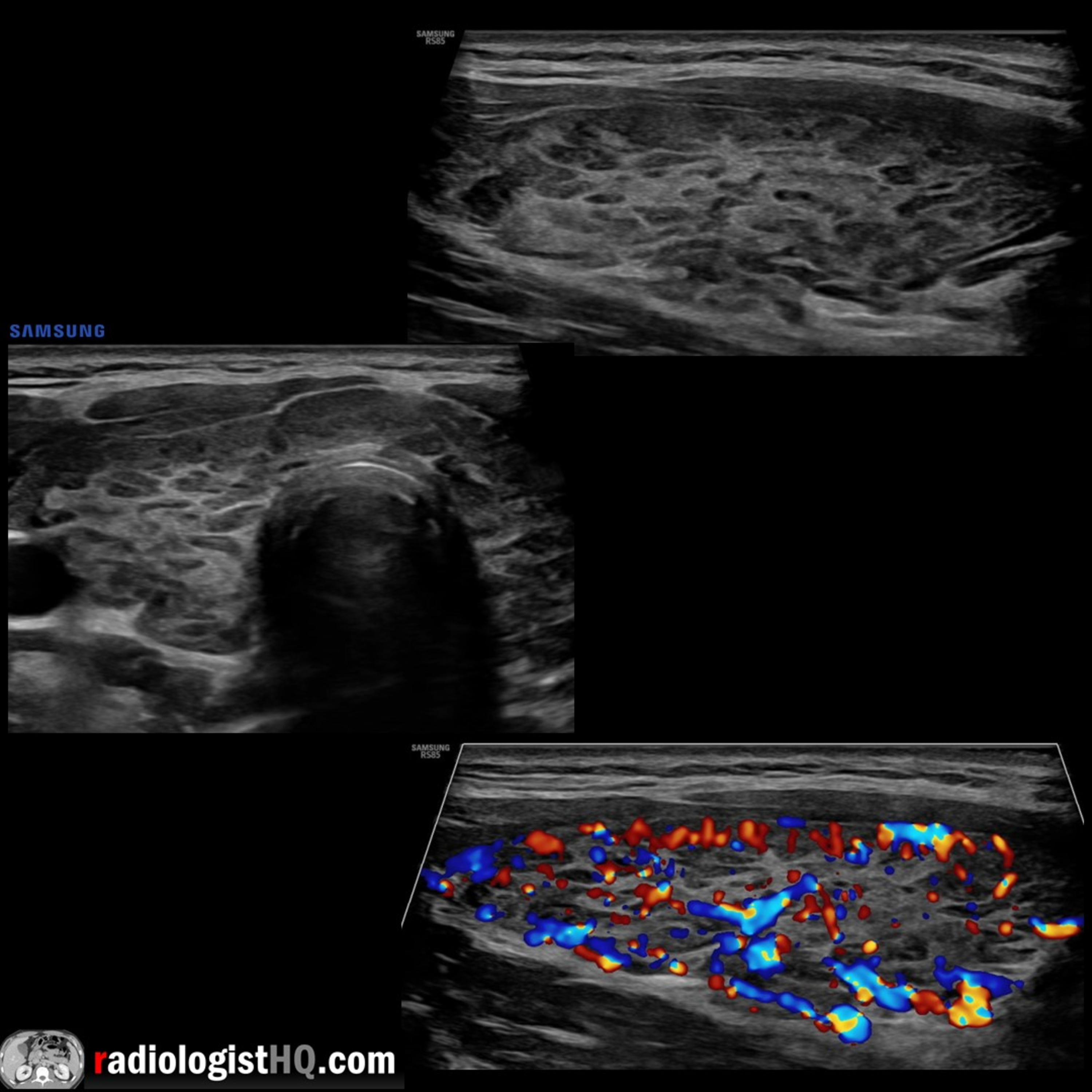 Radiology Lectures | Radquarters