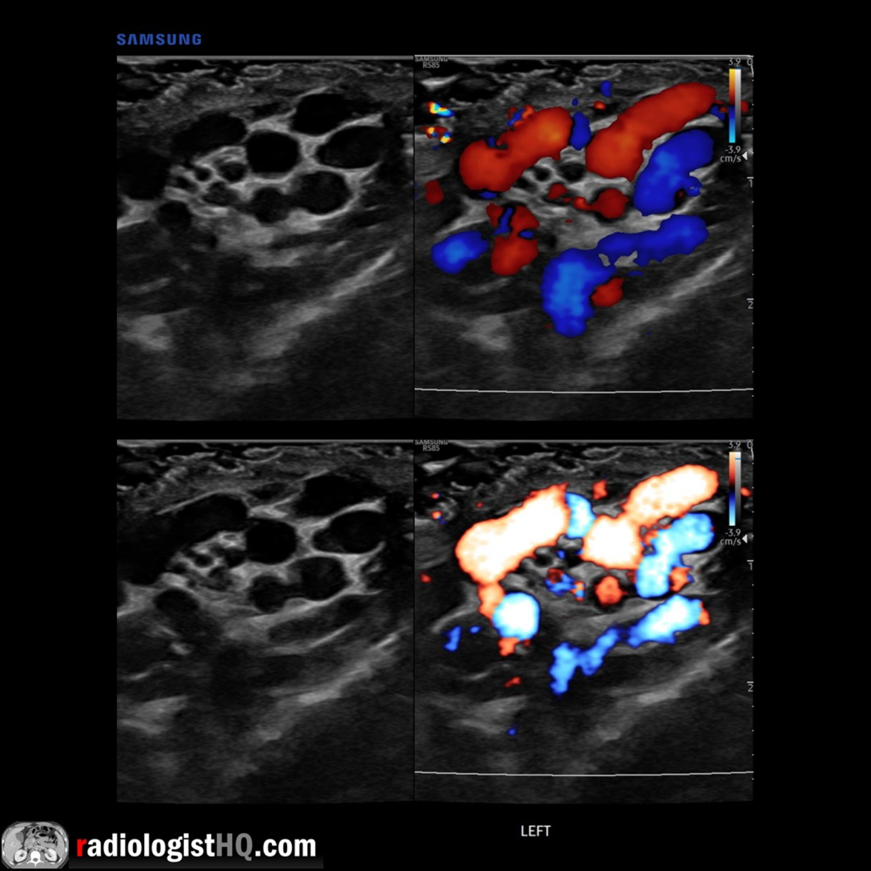 Radiology Lectures | Radquarters
