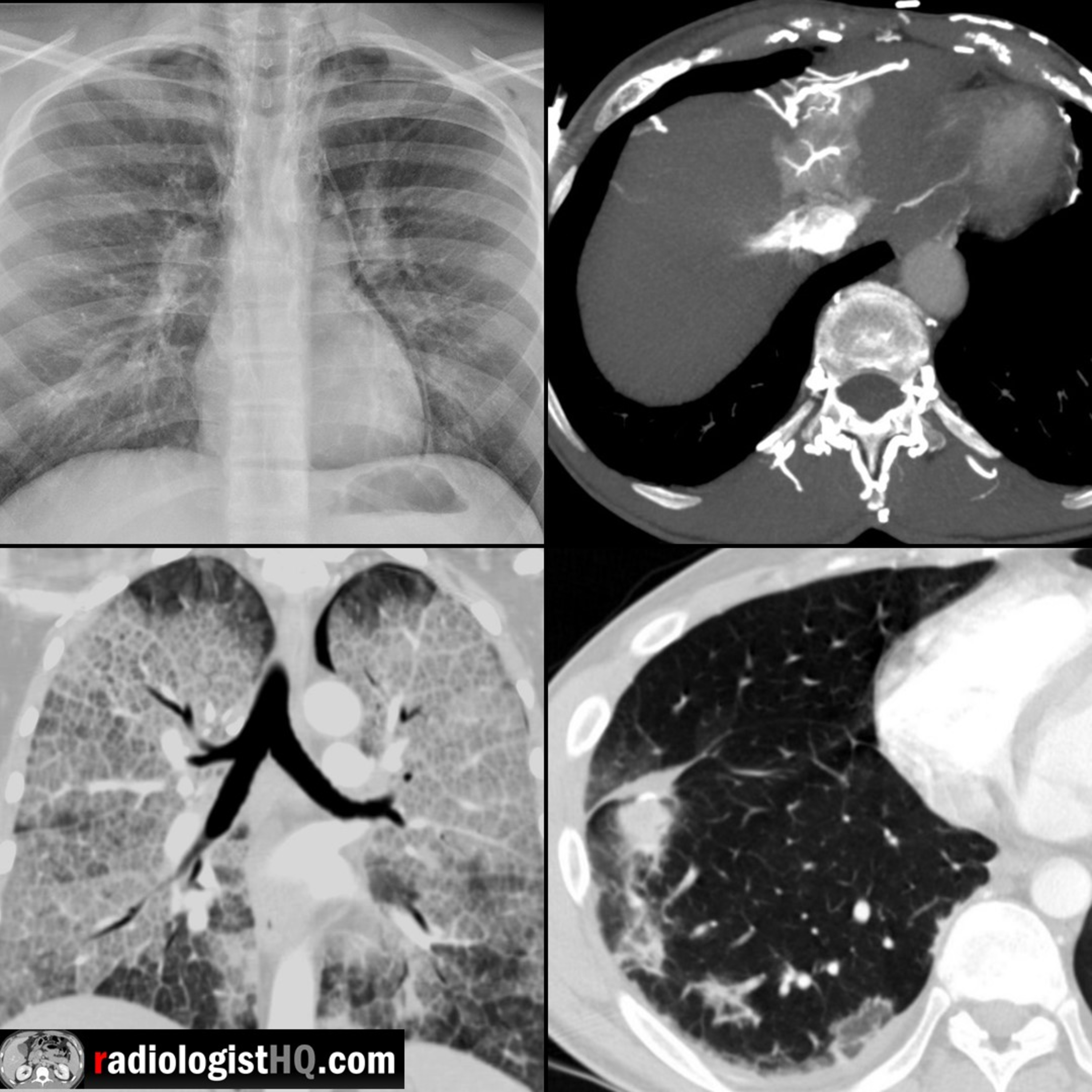 Radiology Lectures | Radquarters