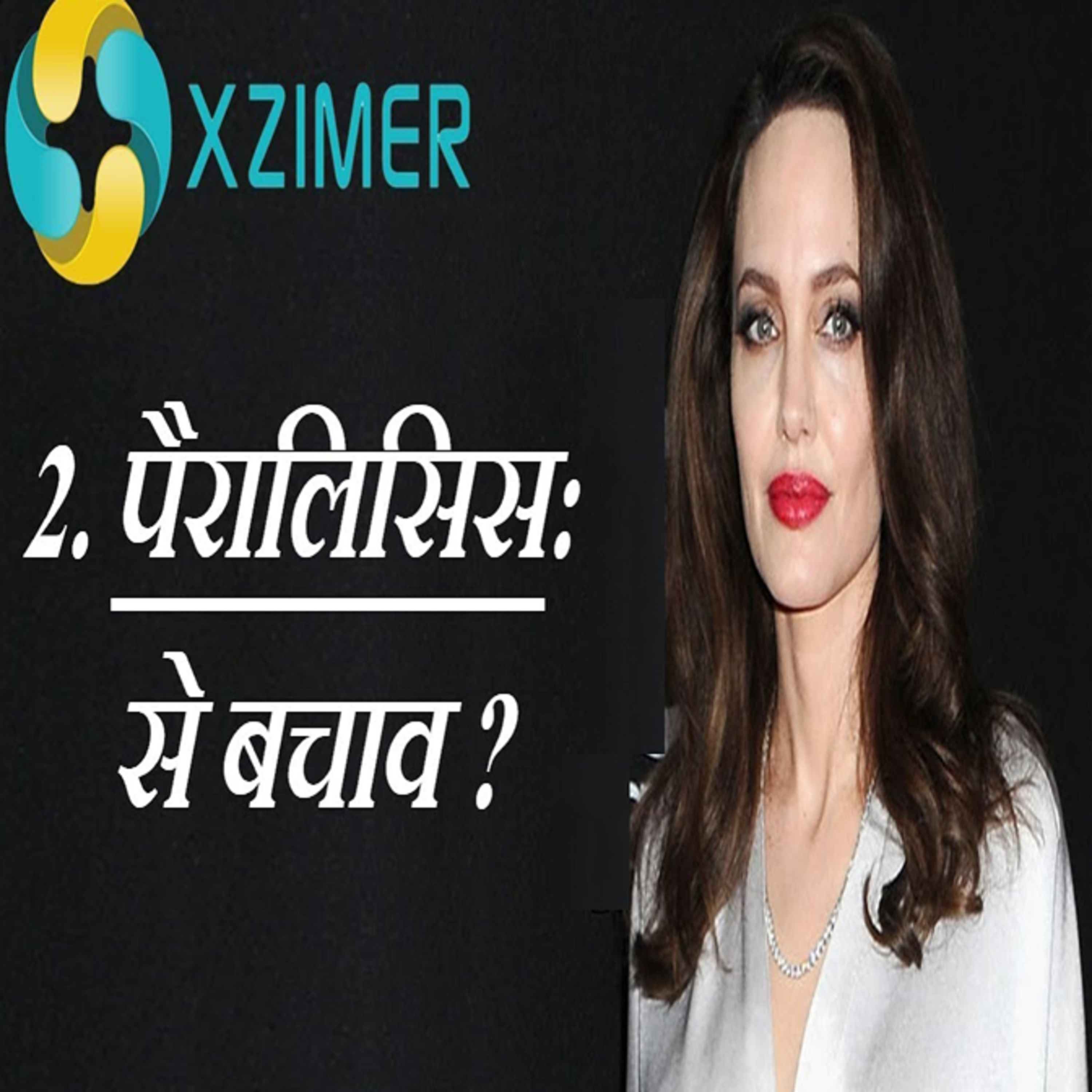 What Are The Treatment Of Paralysis? || PARALYSIS KA ILAJ KYA HAI? episode artwork