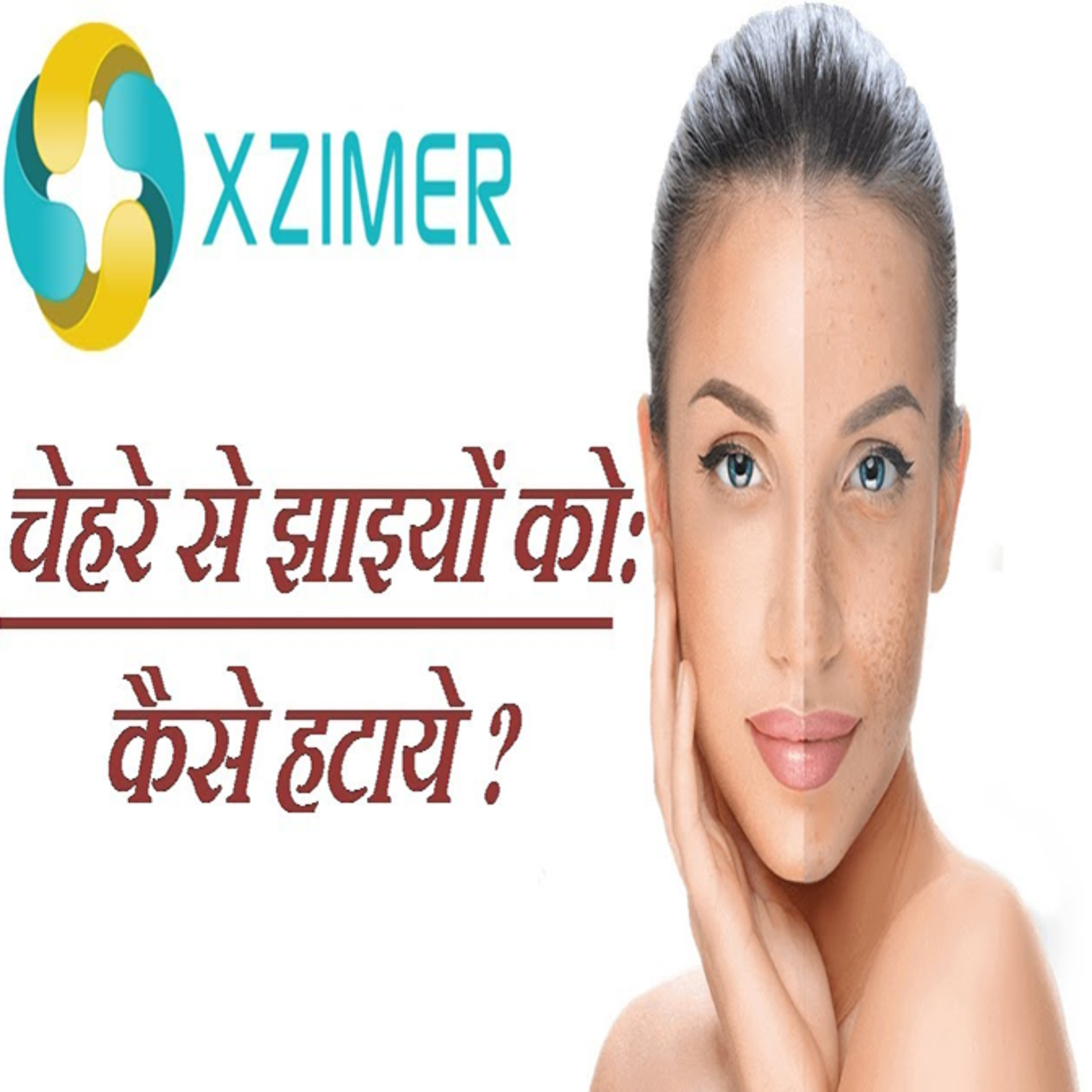 झाइयों का कारण और इलाज | Melasma Causes & Treatment in Hindi episode artwork