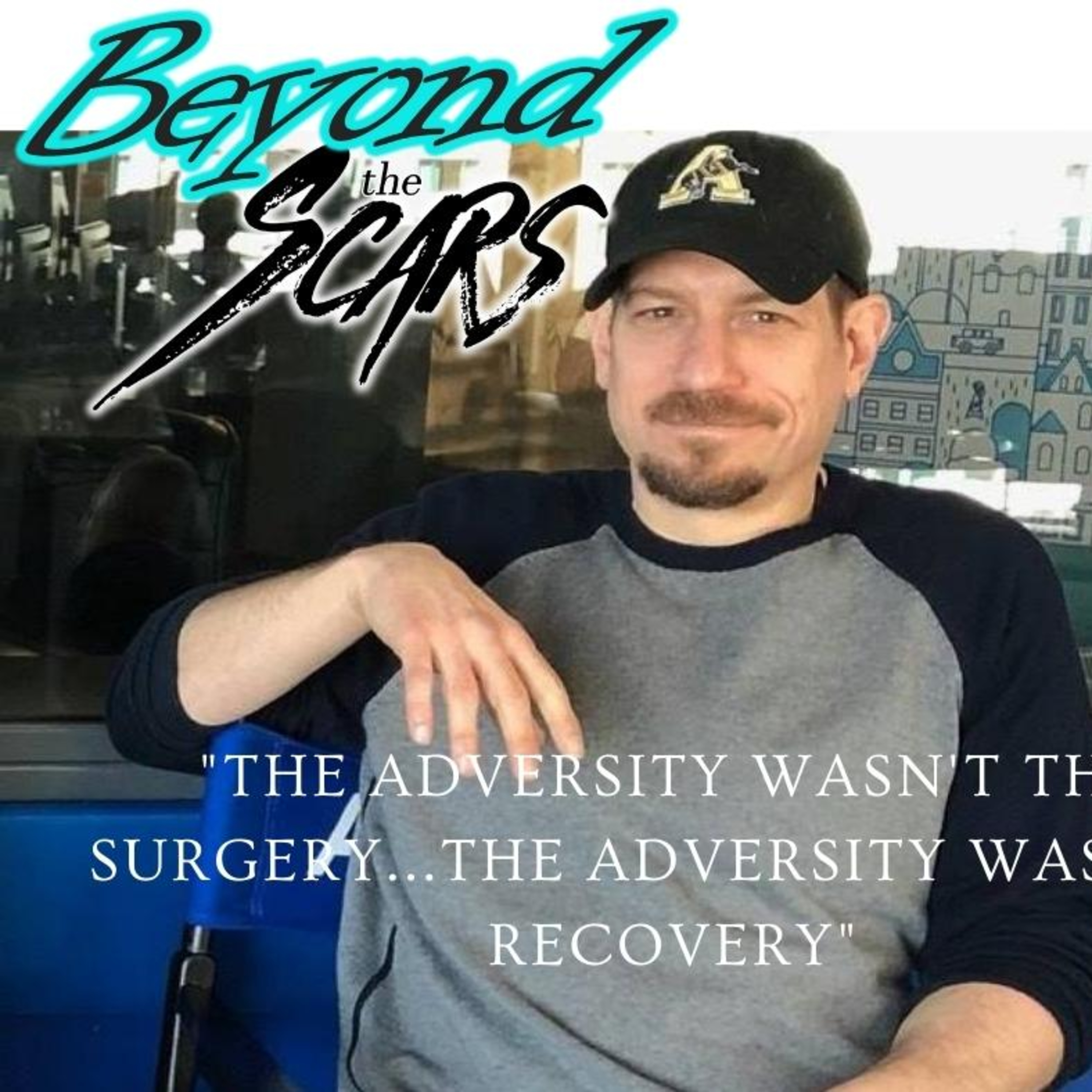 A Broken Heart: Doug's Story of Surviving an Aneurysm