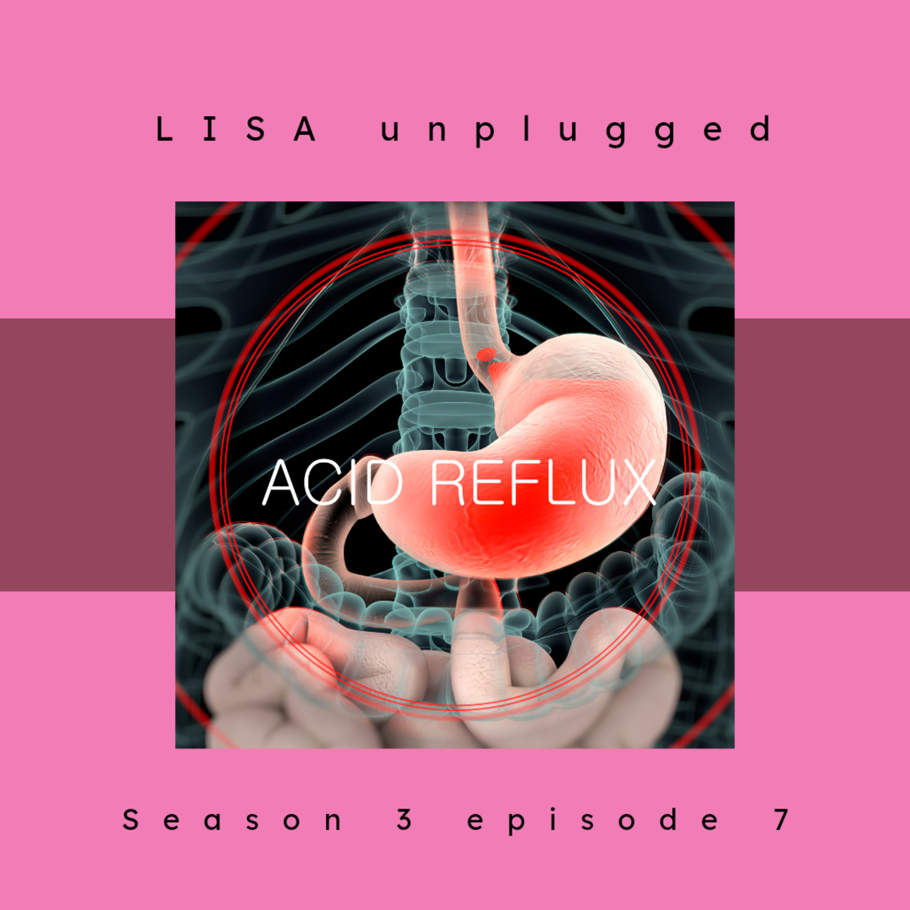 Acid Reflux  episode artwork