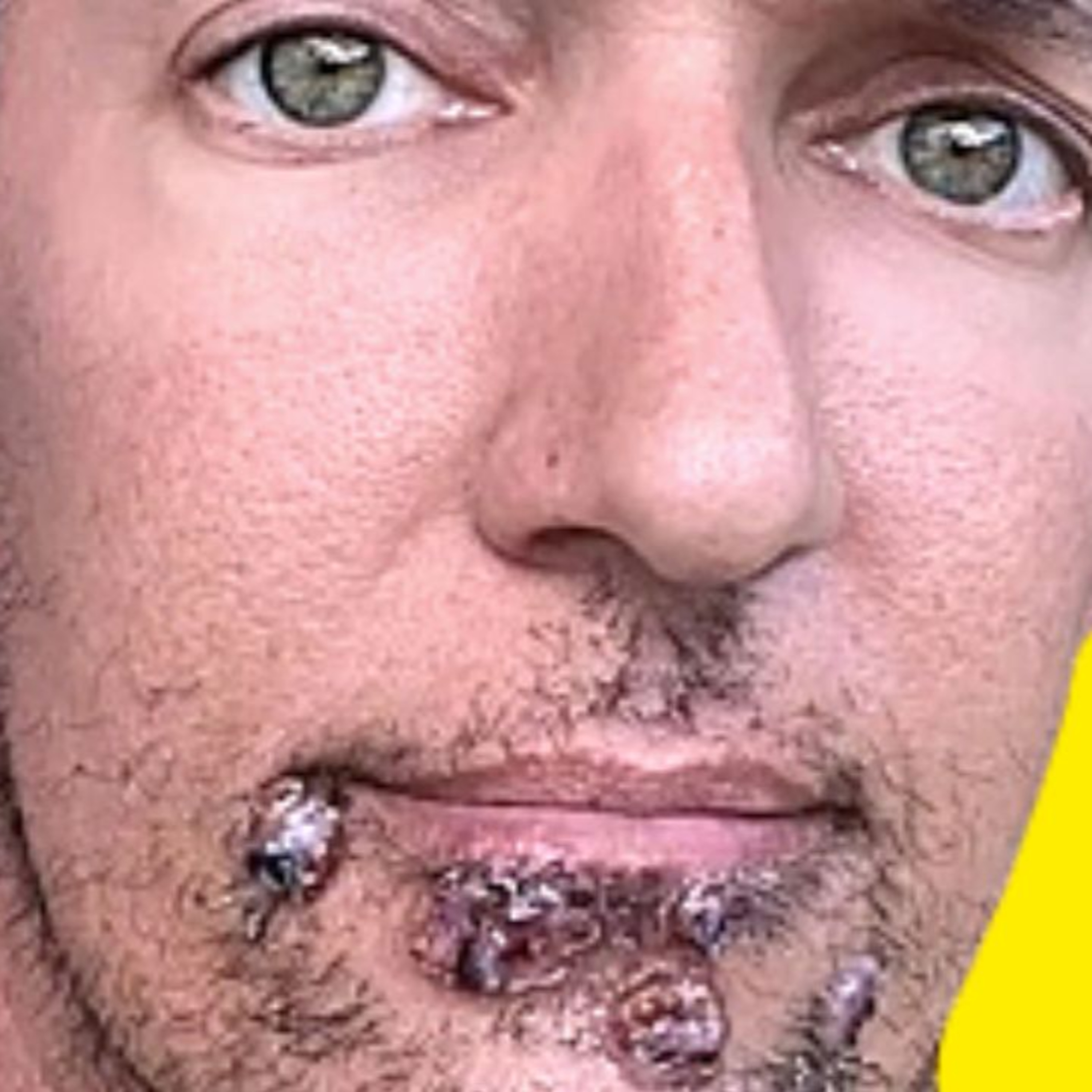 Most DISTURBING Monkeypox Selfies episode artwork