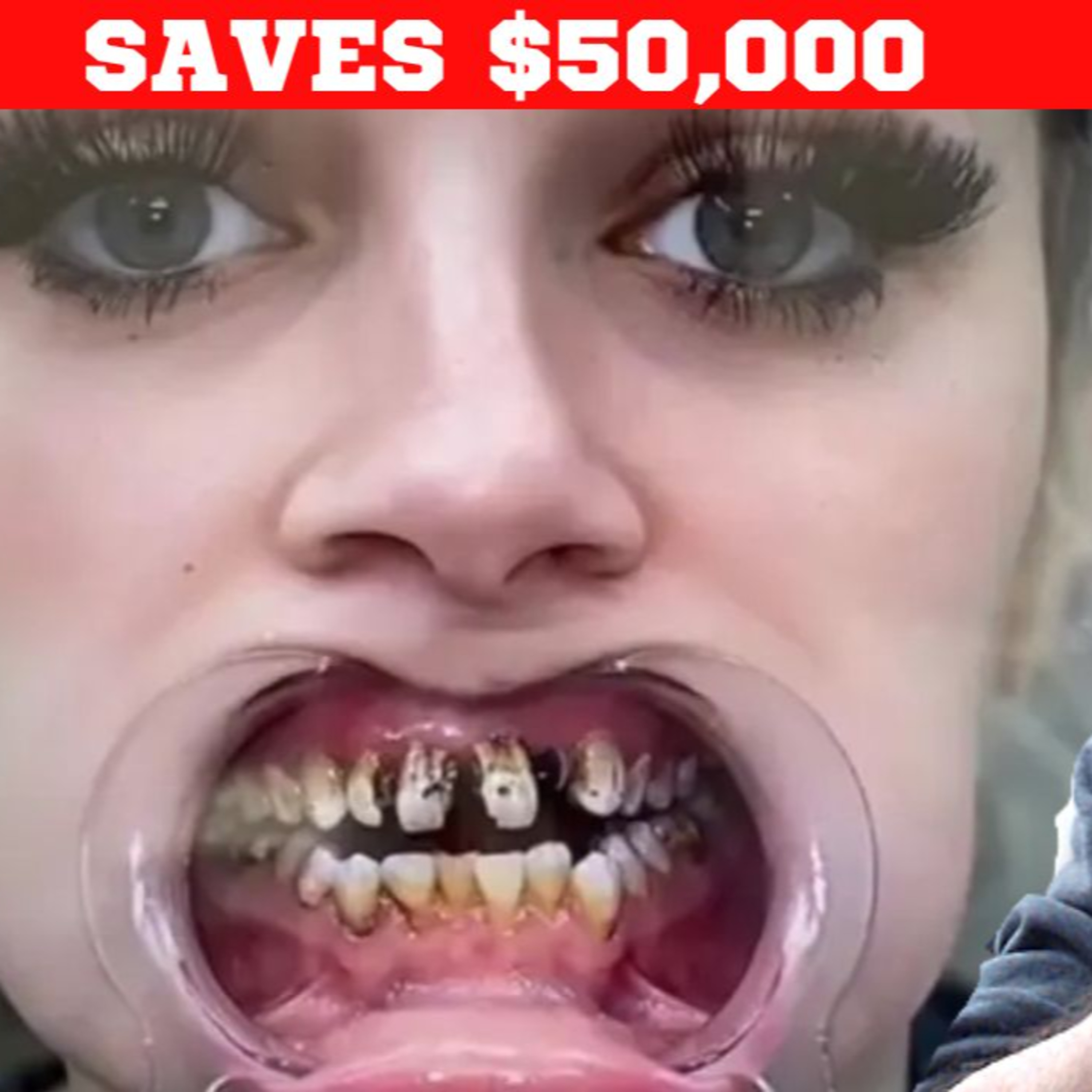 TIKTOK GIRL WINS NEW SMILE! episode artwork