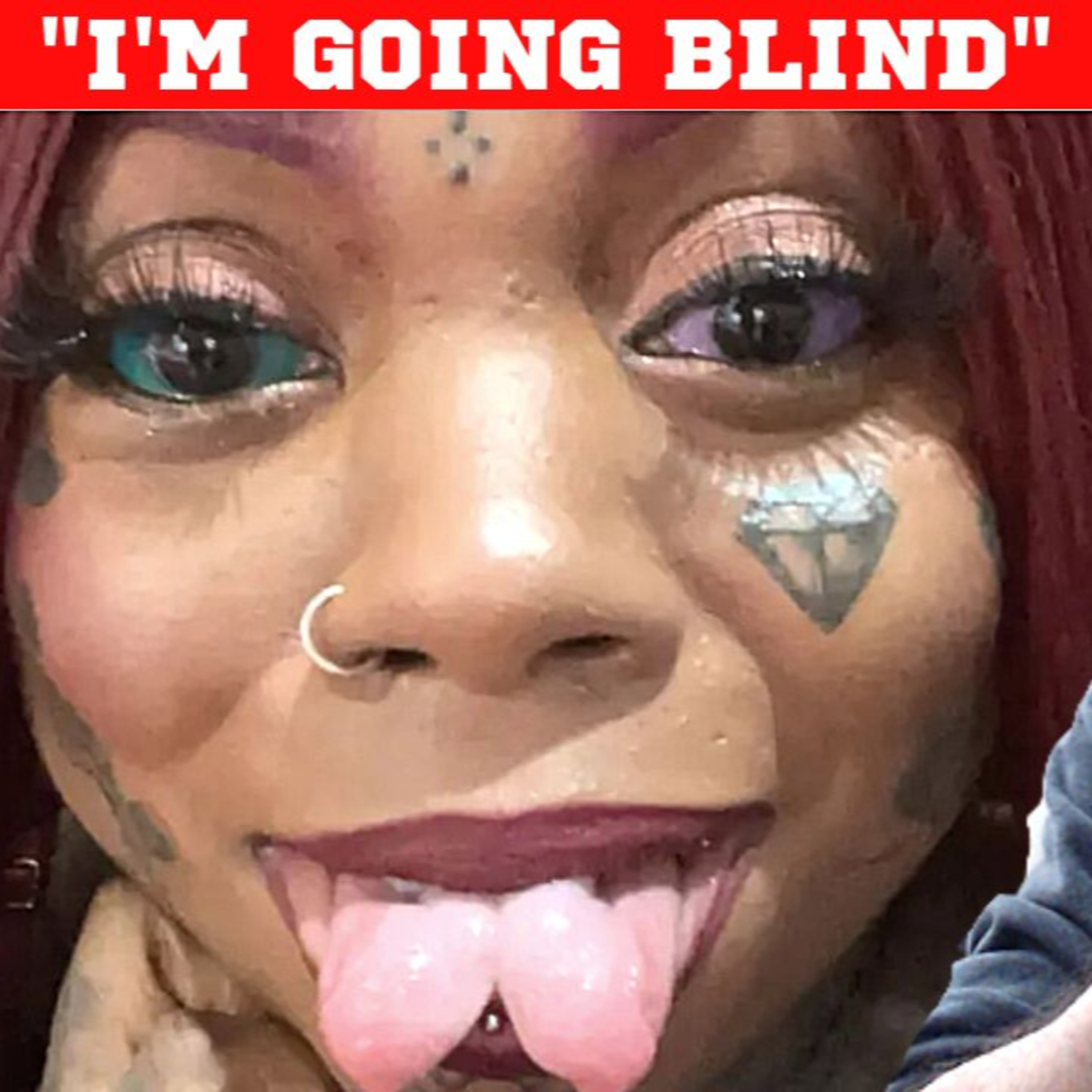 MOM TATTOOED HER EYEBALLS, BUT NOW SHE CAN'T SEE episode artwork