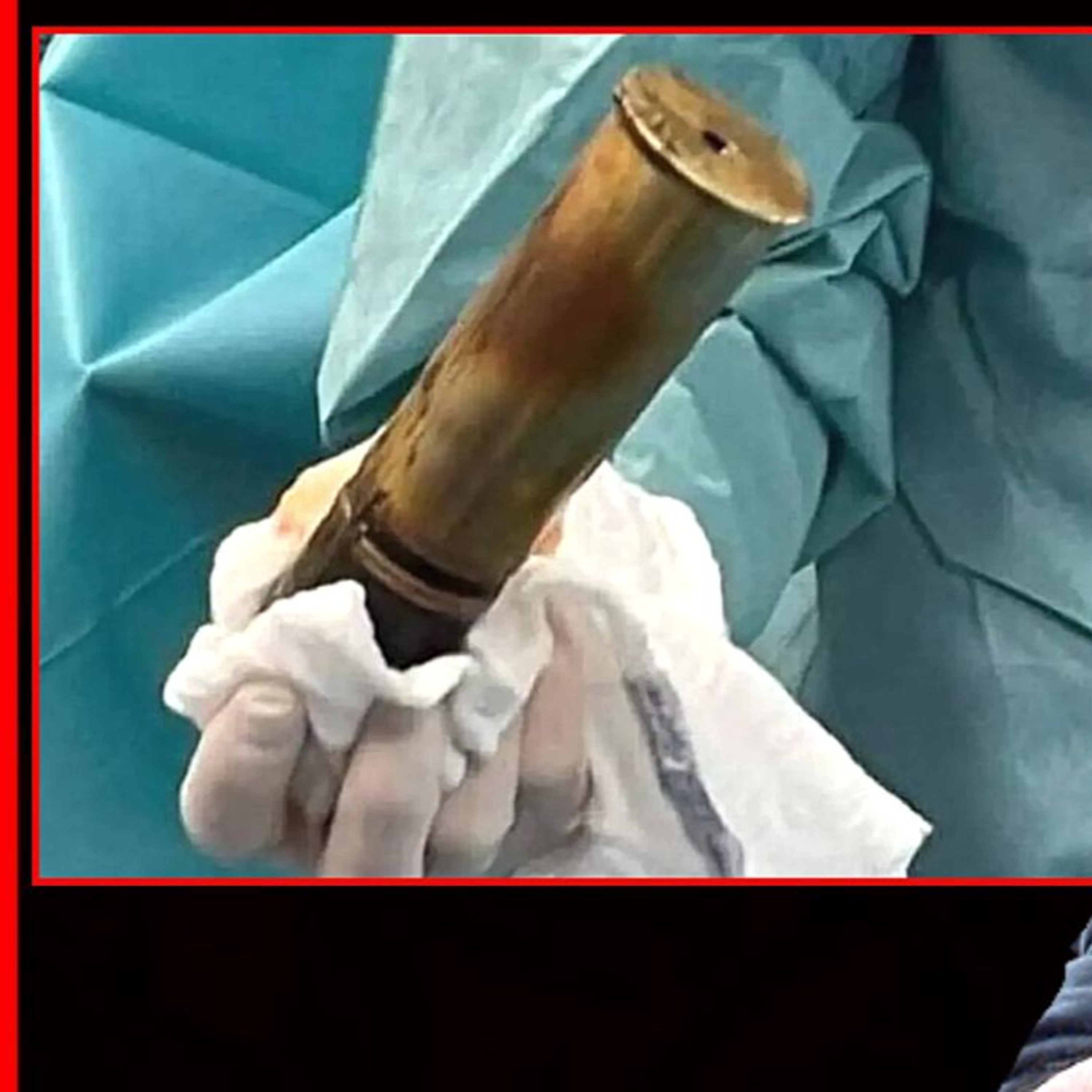 WWI EXPLOSIVE STUCK INSIDE MAN'S BUTT... episode artwork