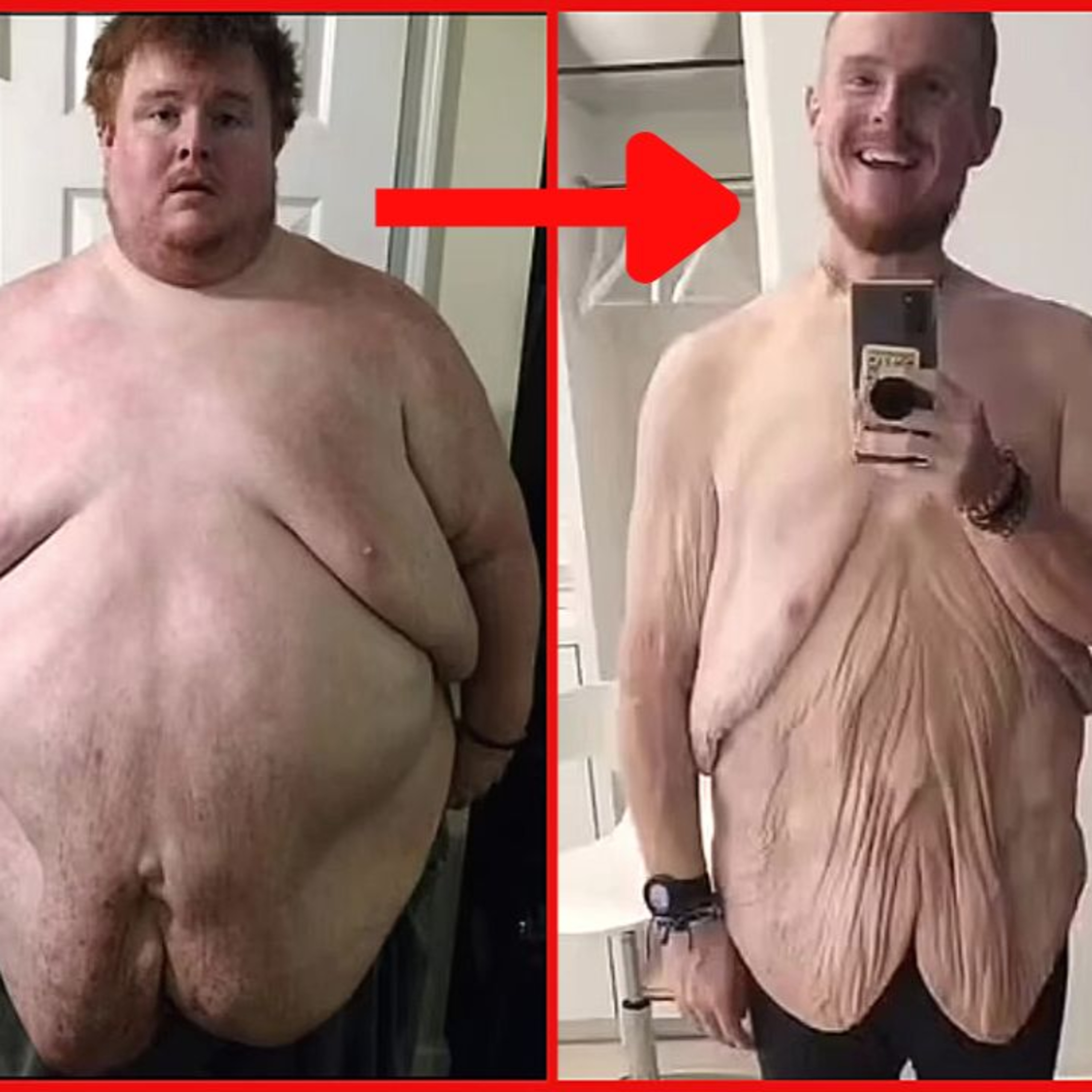 AMAZING! OBESE Star Lost 600 Pounds! episode artwork