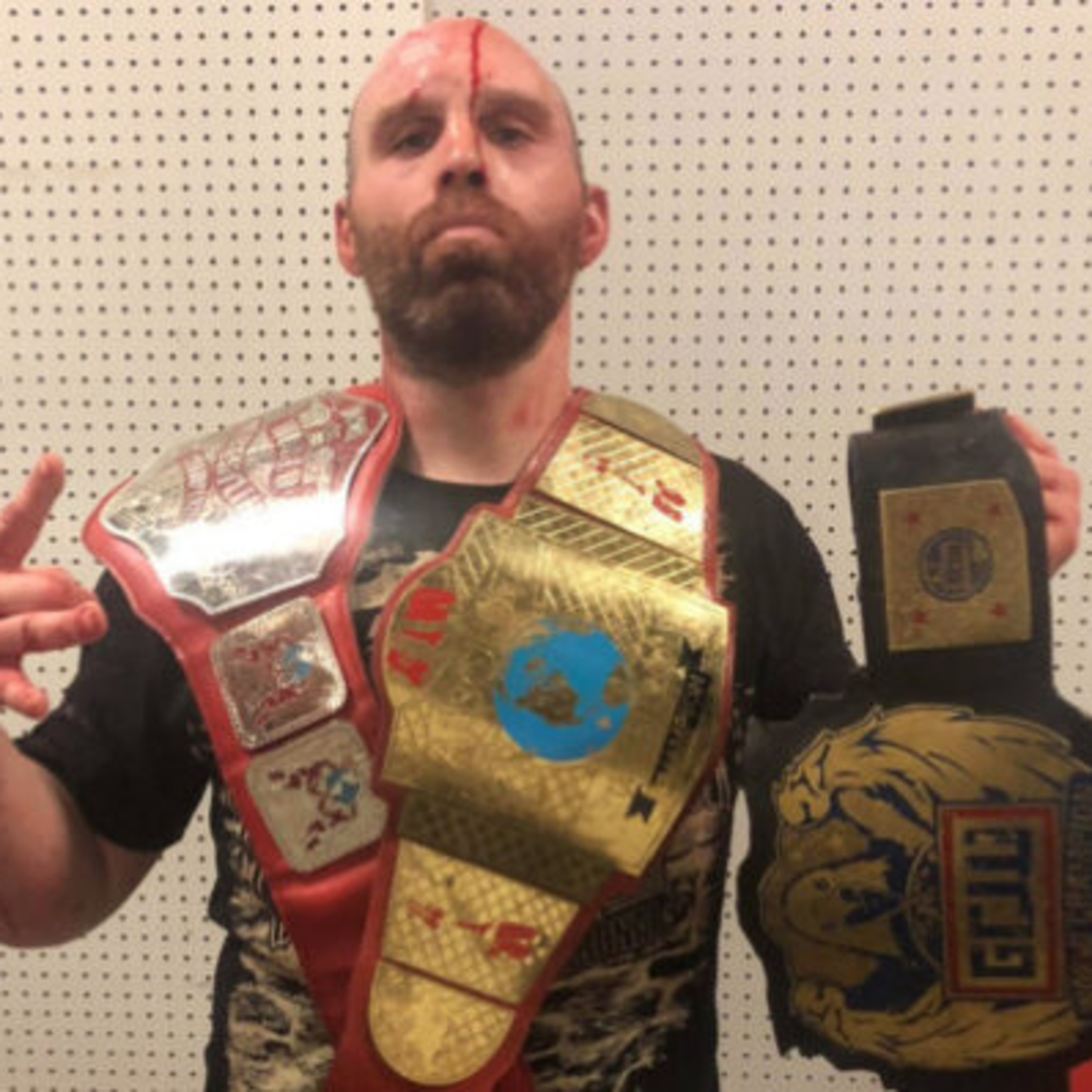 Dark Side of The Ring Ep 3: The Ultra-Violence of Nick Gage episode artwork
