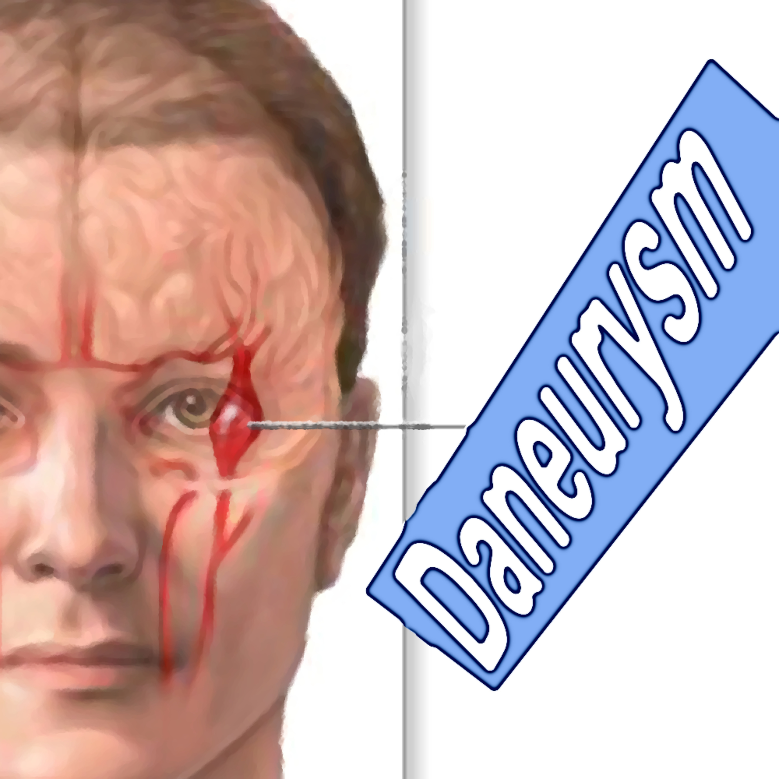 DANEURYSM?  episode artwork