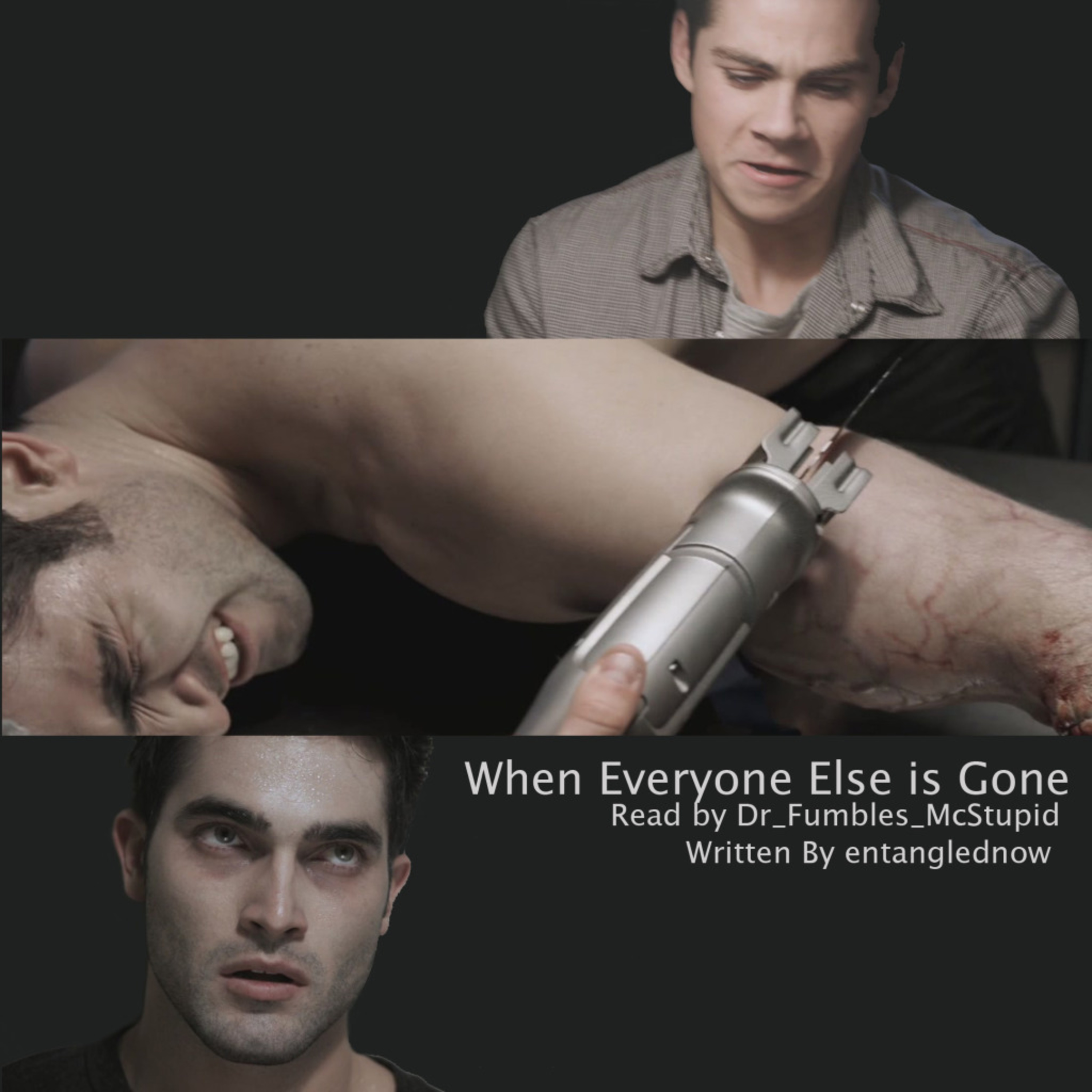 Teen Wolf - When Everyone Else is Gone episode artwork