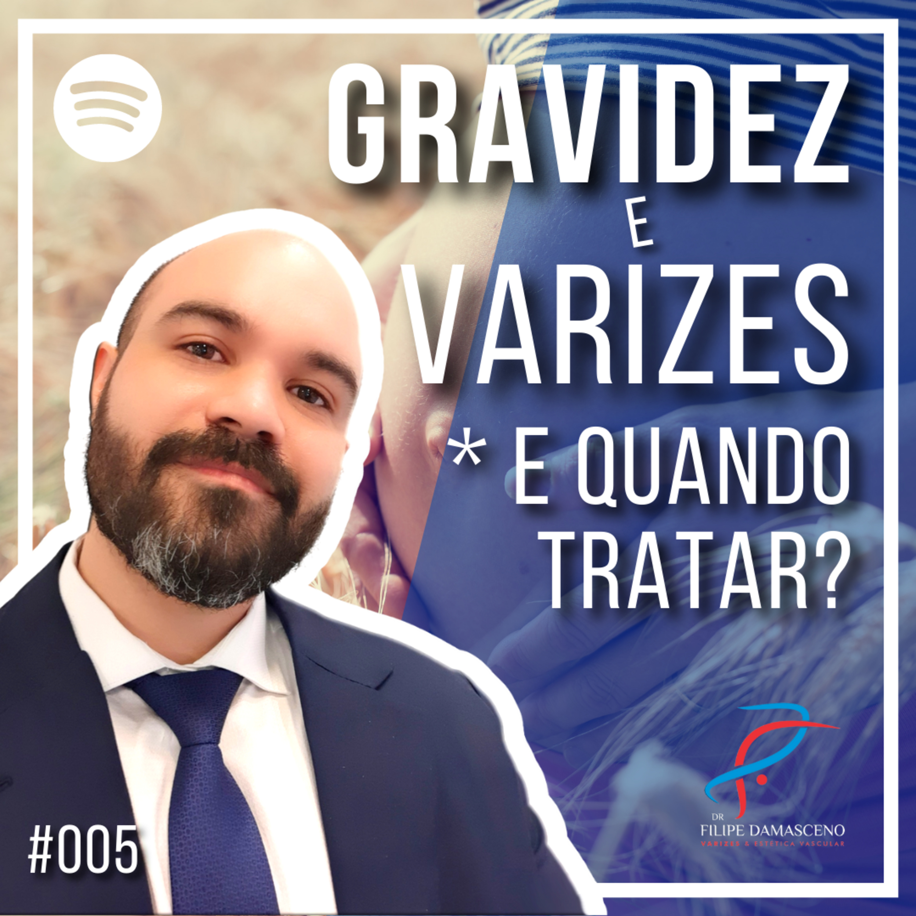 Filipe Damasceno | Vida sem Varizes