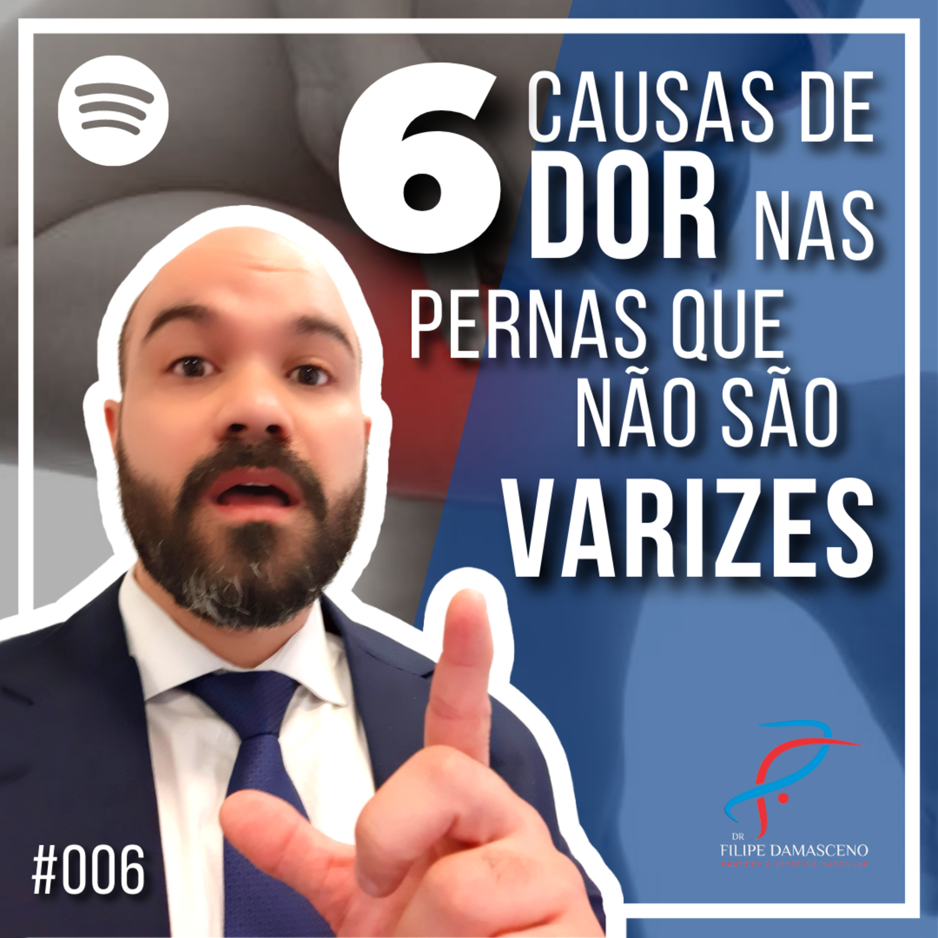Filipe Damasceno | Vida sem Varizes
