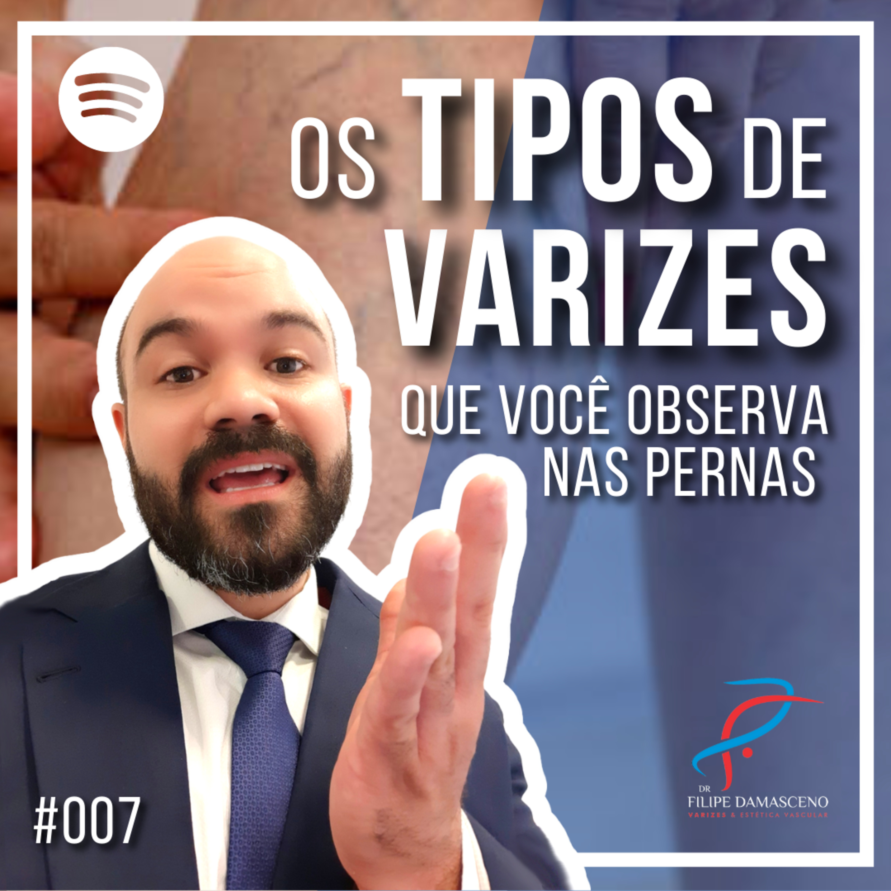 Filipe Damasceno | Vida sem Varizes