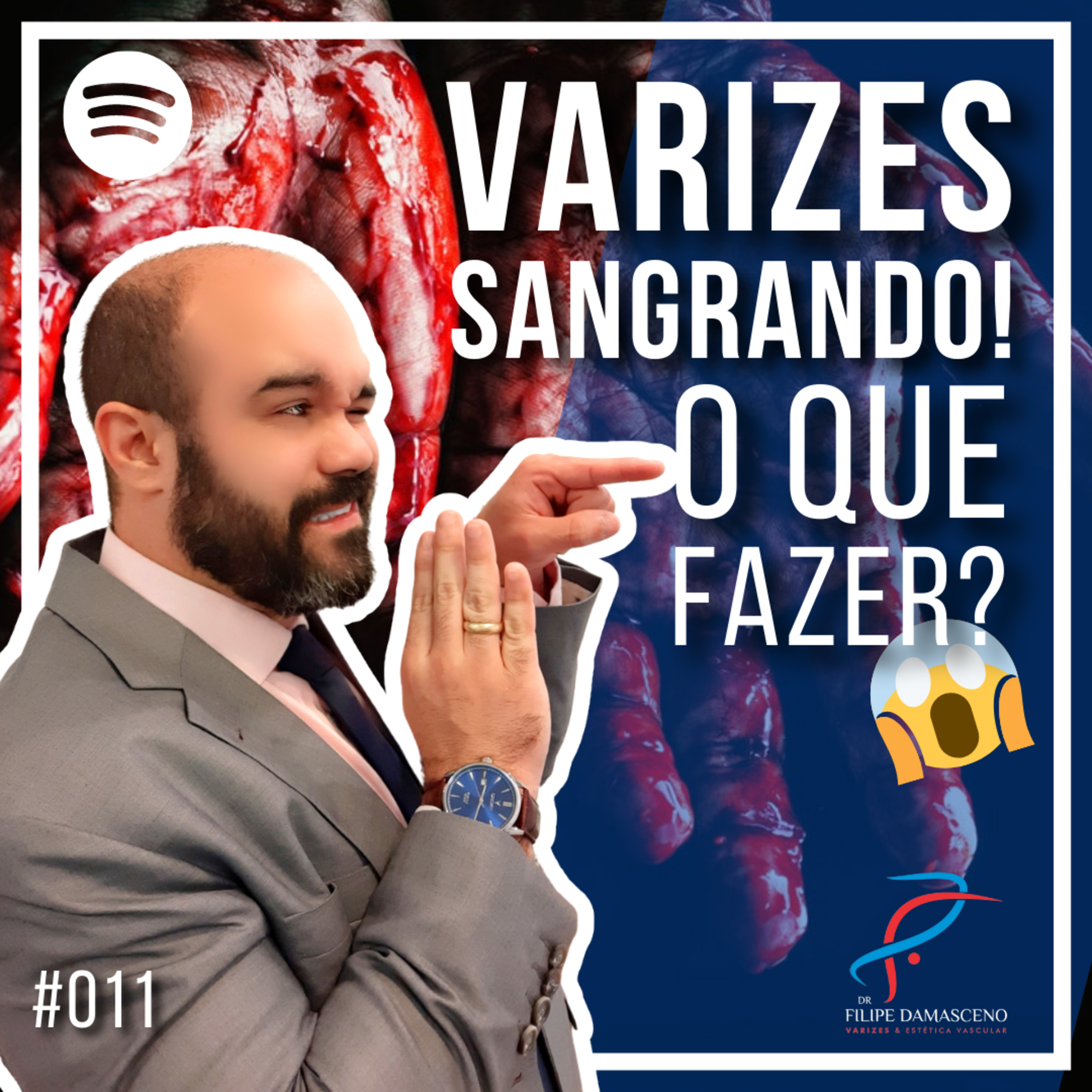 Filipe Damasceno | Vida sem Varizes