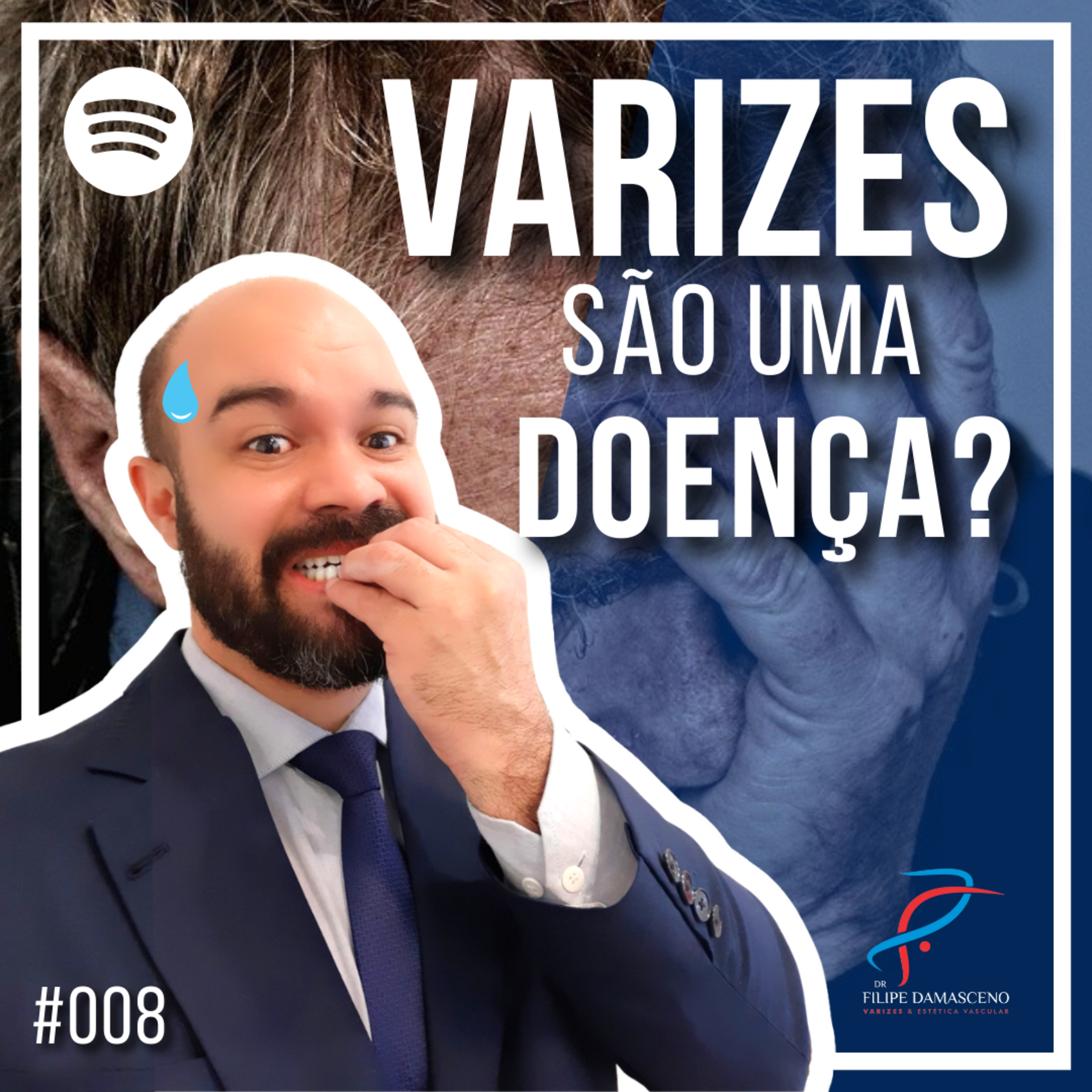 Filipe Damasceno | Vida sem Varizes