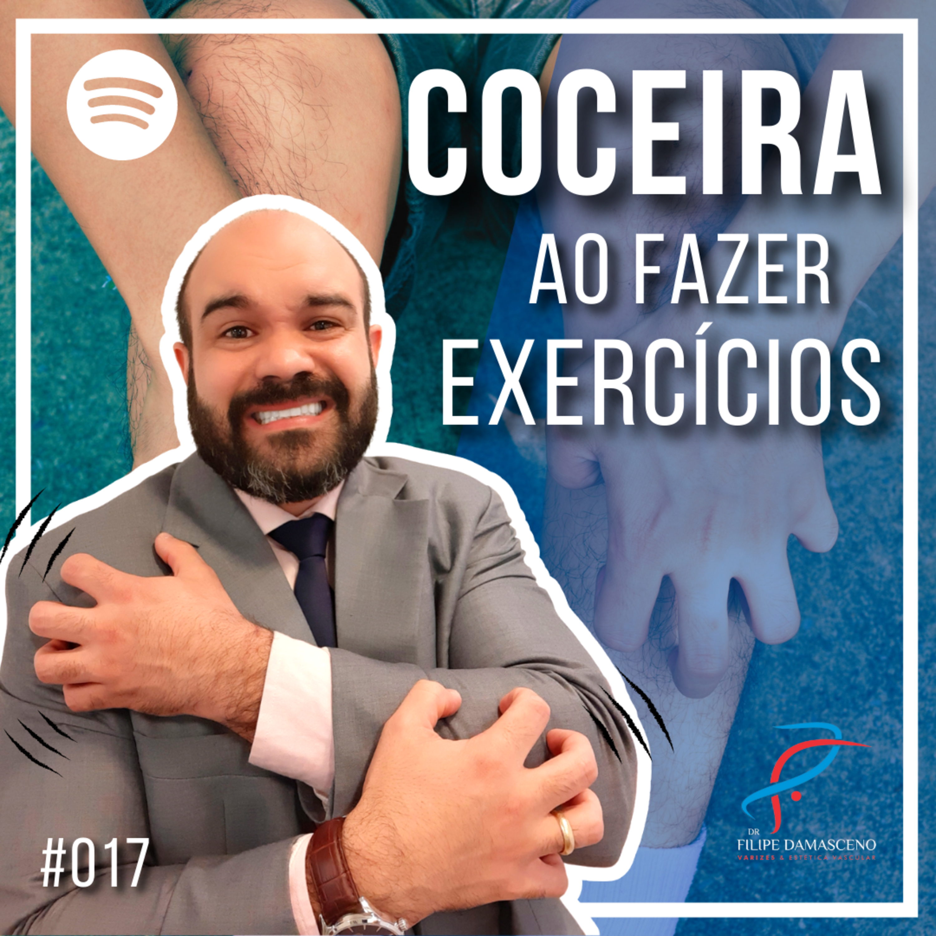 Filipe Damasceno | Vida sem Varizes