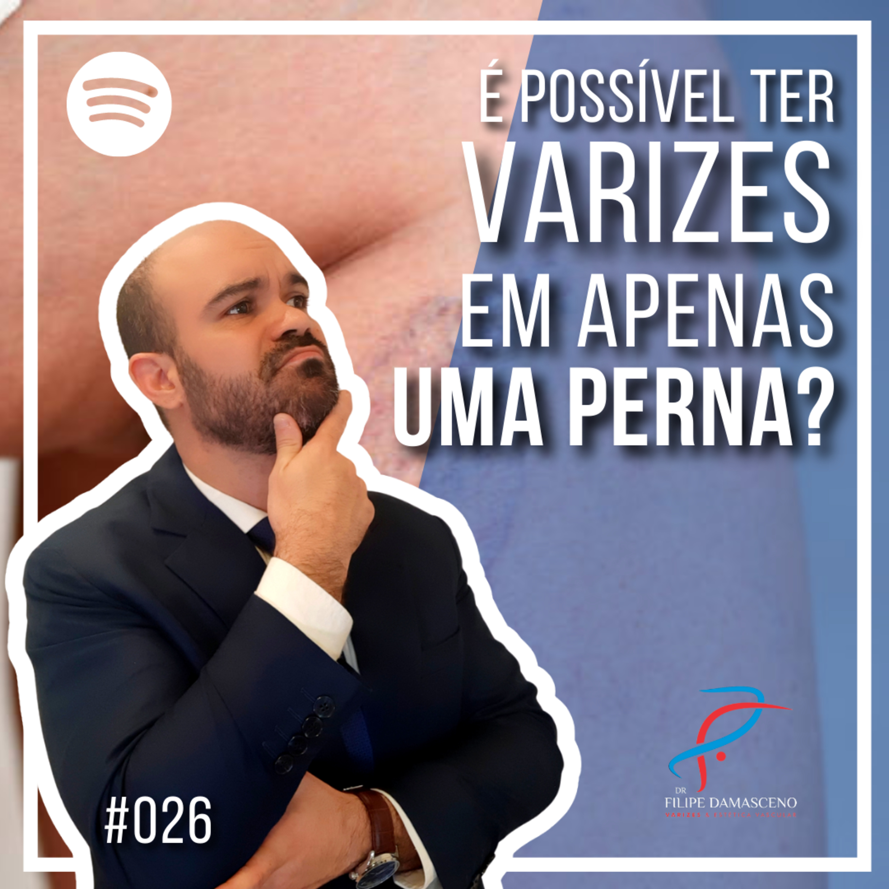 Filipe Damasceno | Vida sem Varizes