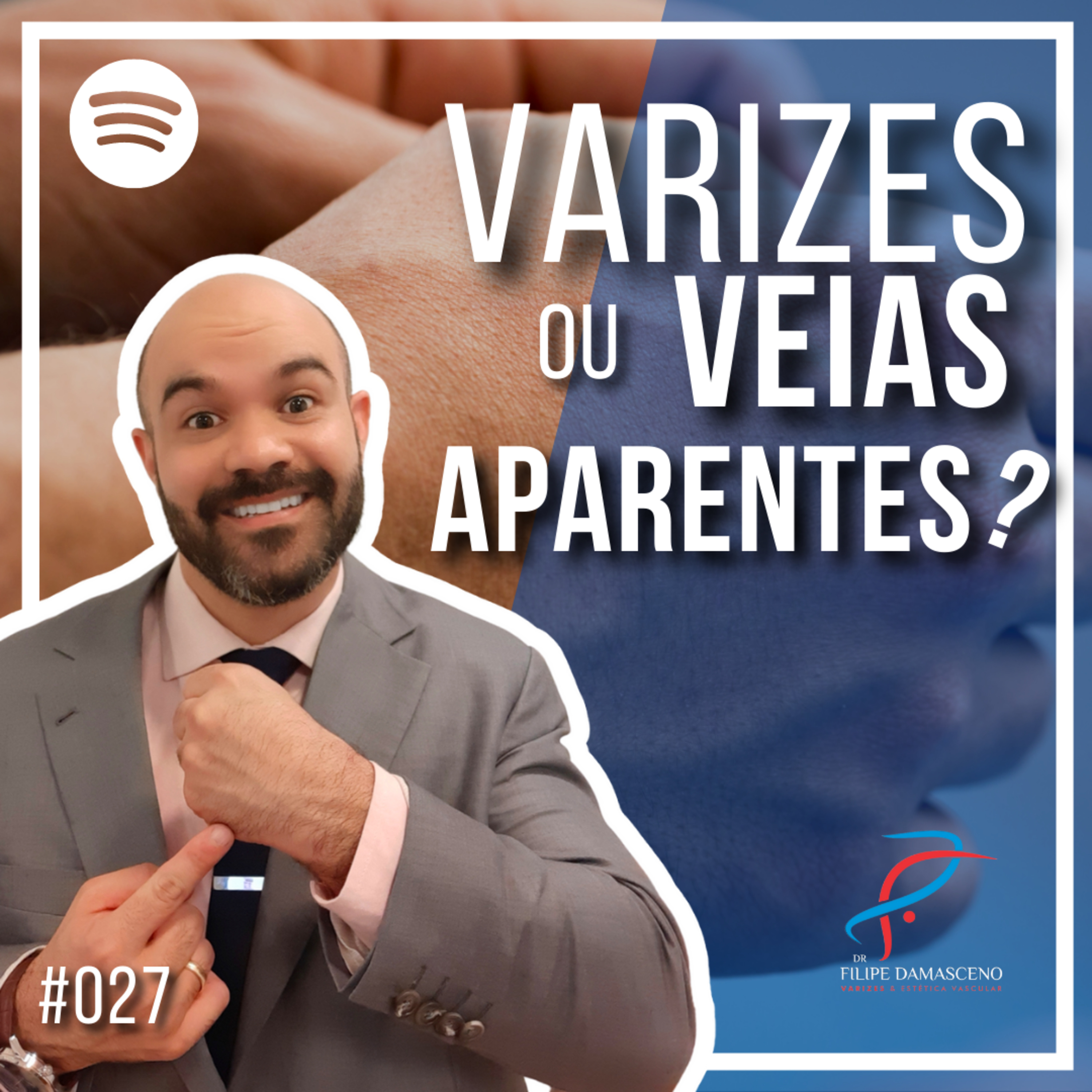 Filipe Damasceno | Vida sem Varizes