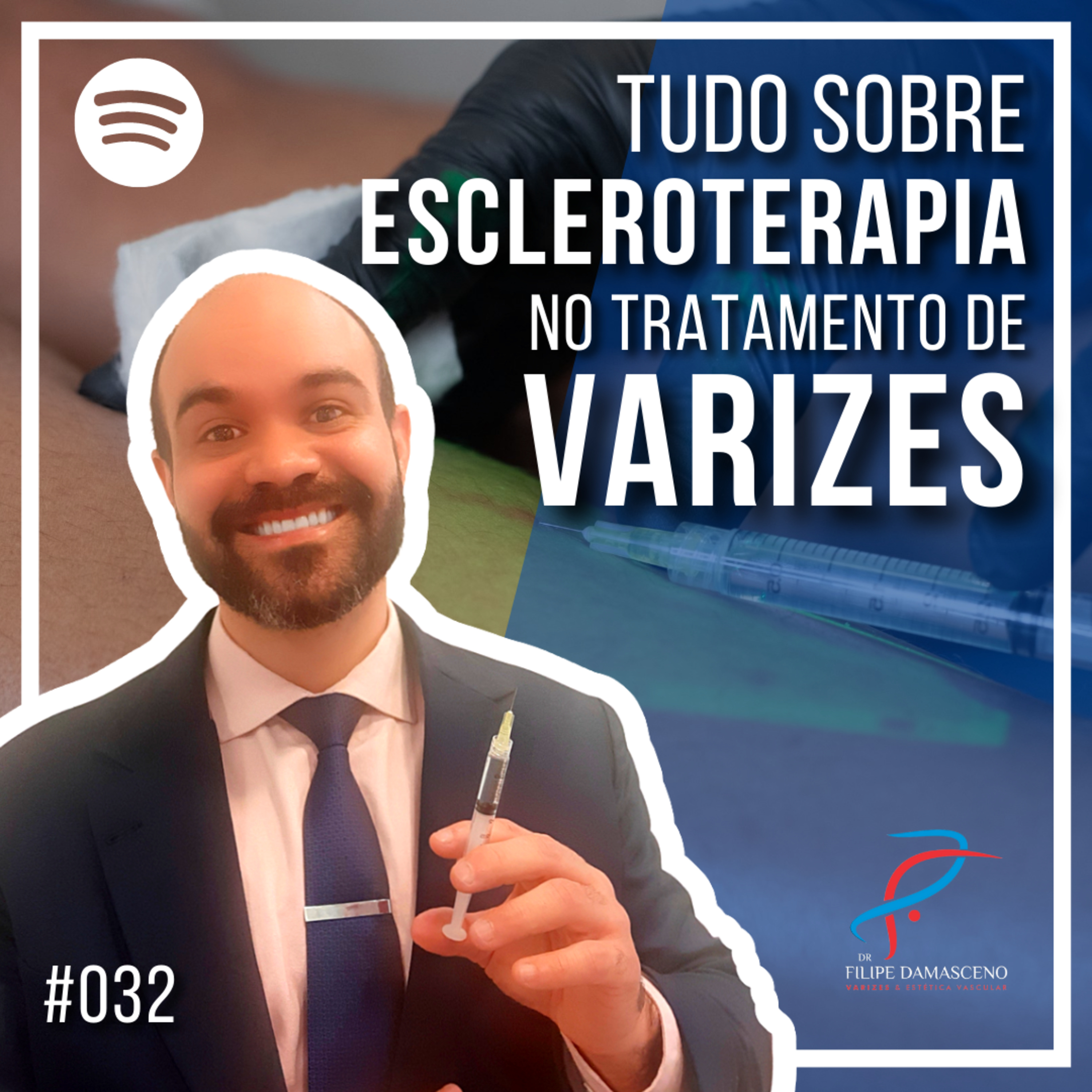 Filipe Damasceno | Vida sem Varizes