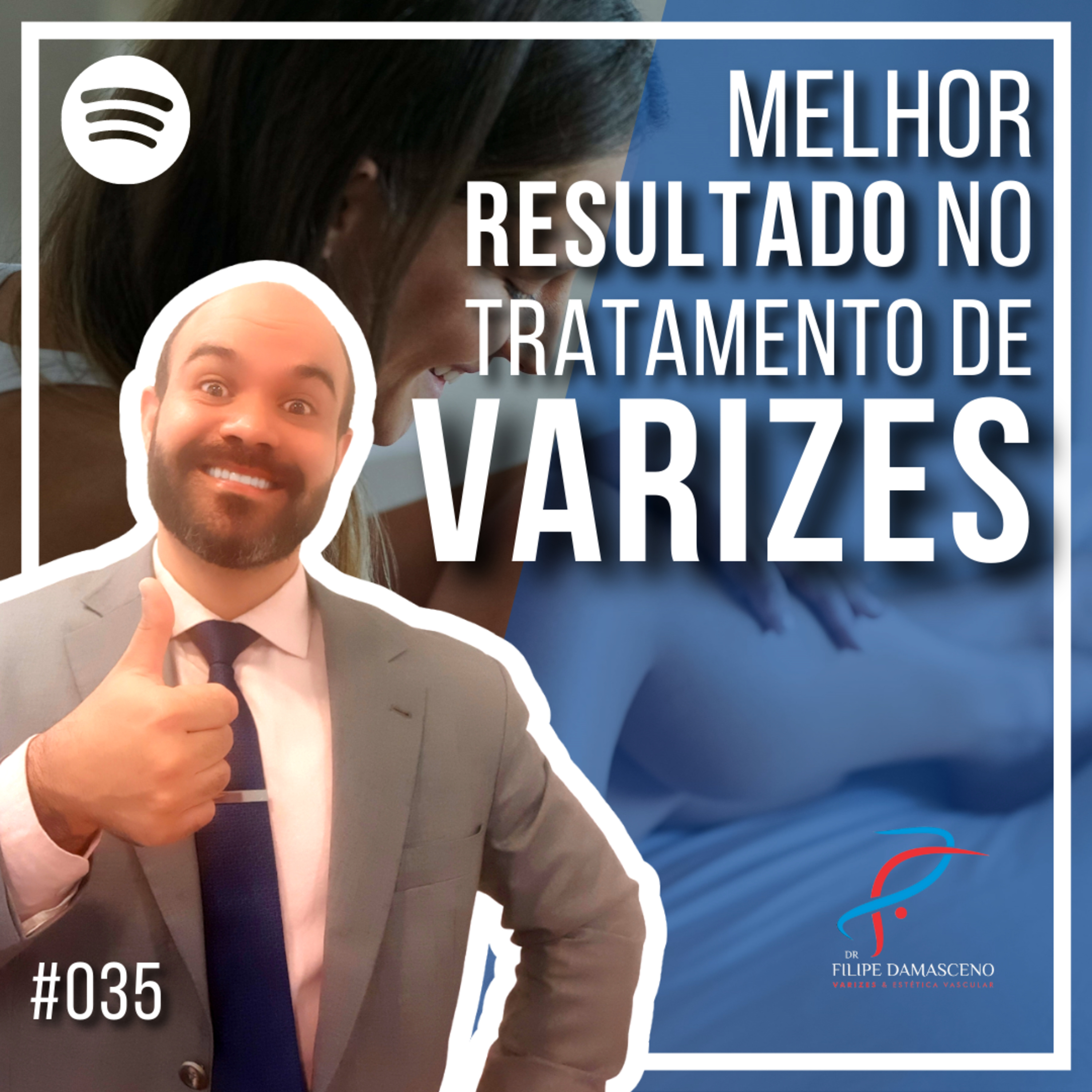 Filipe Damasceno | Vida sem Varizes