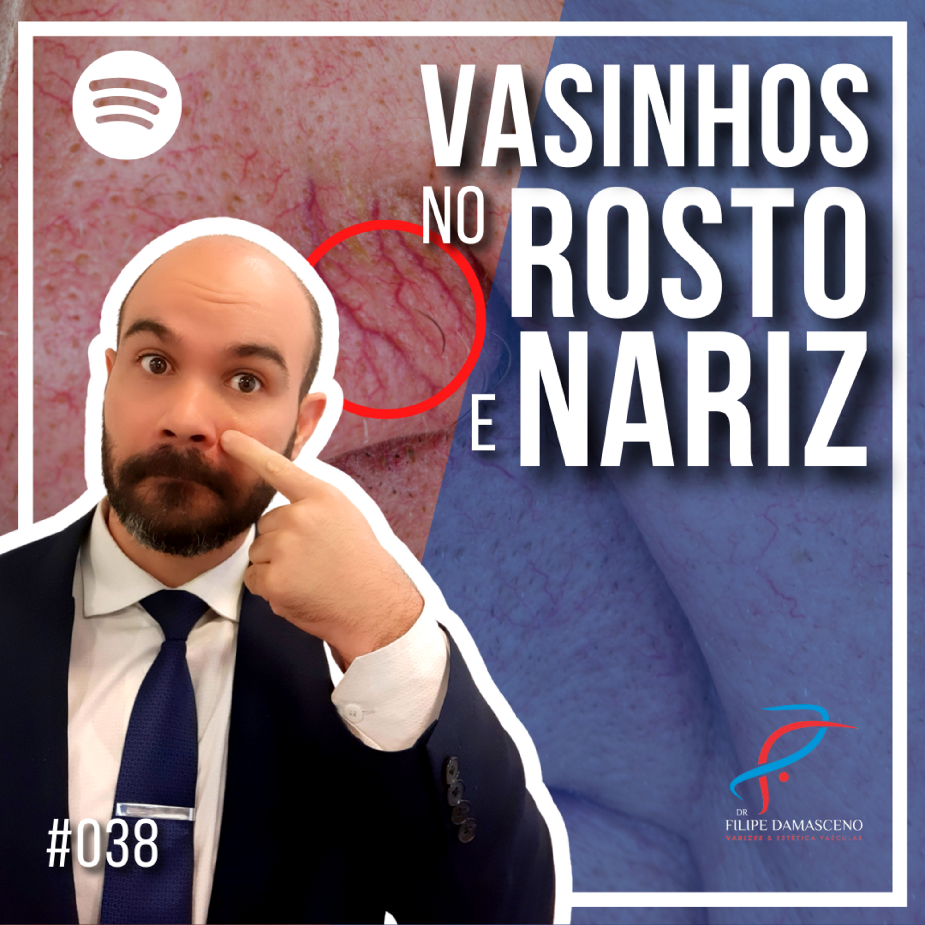 Filipe Damasceno | Vida sem Varizes