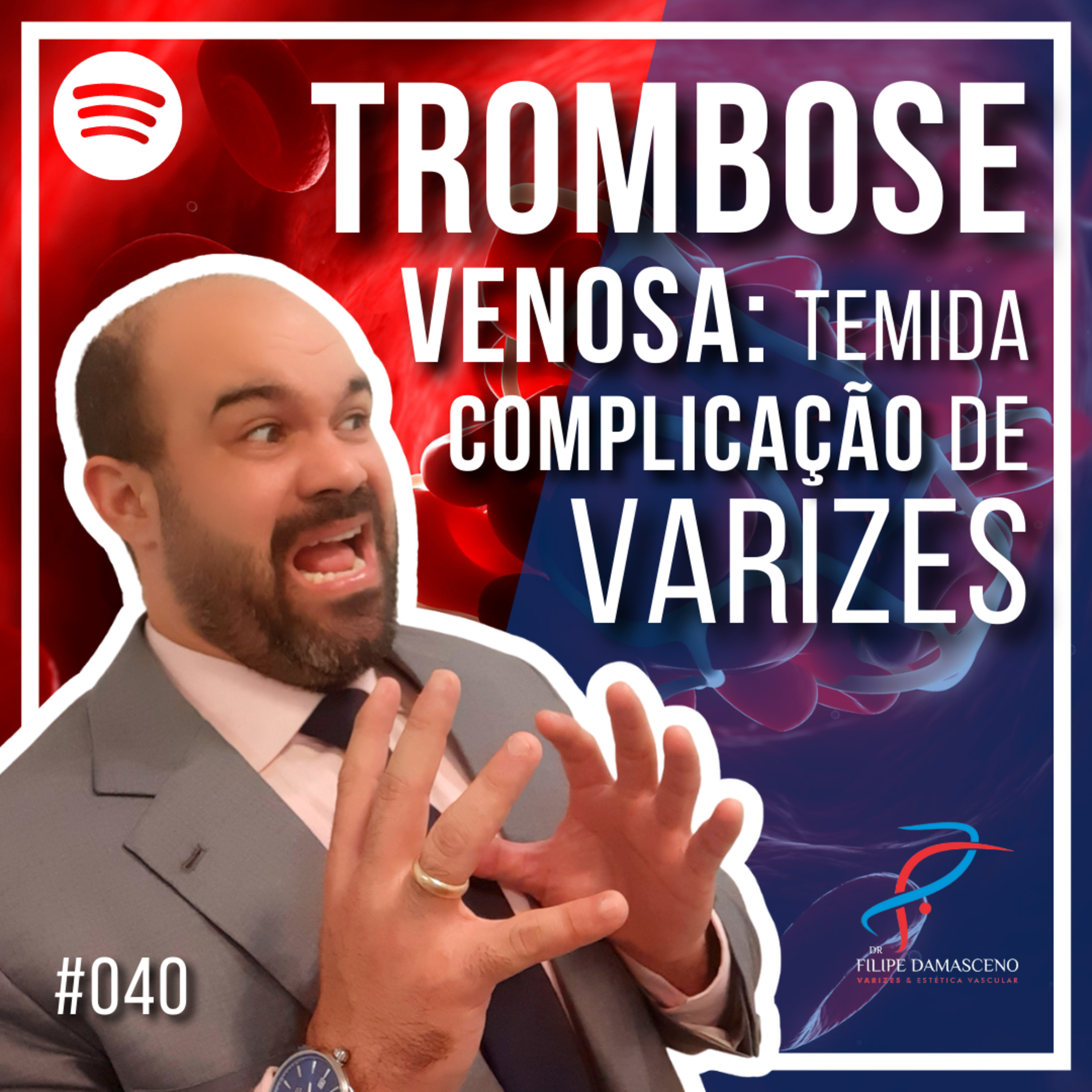 Filipe Damasceno | Vida sem Varizes