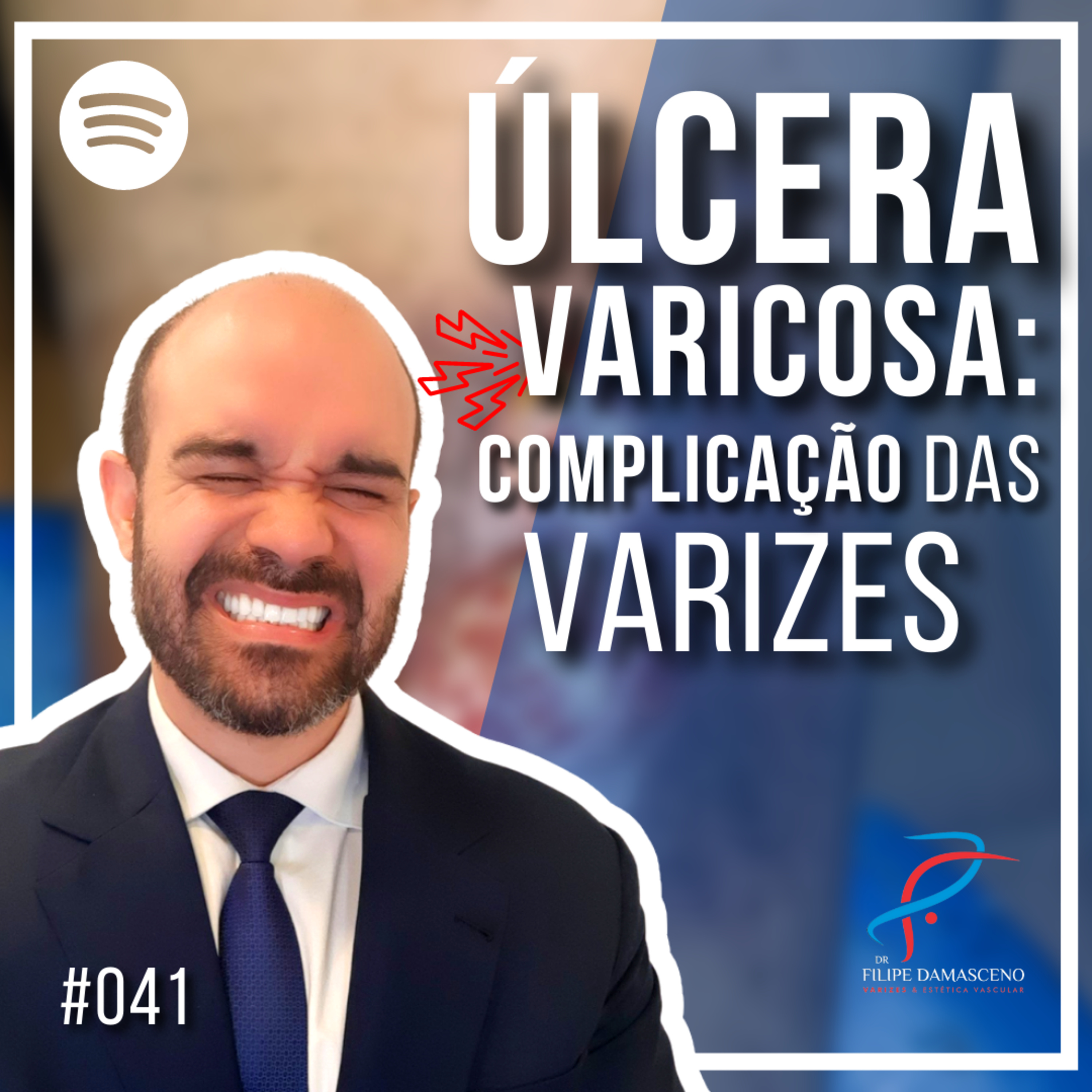 Filipe Damasceno | Vida sem Varizes