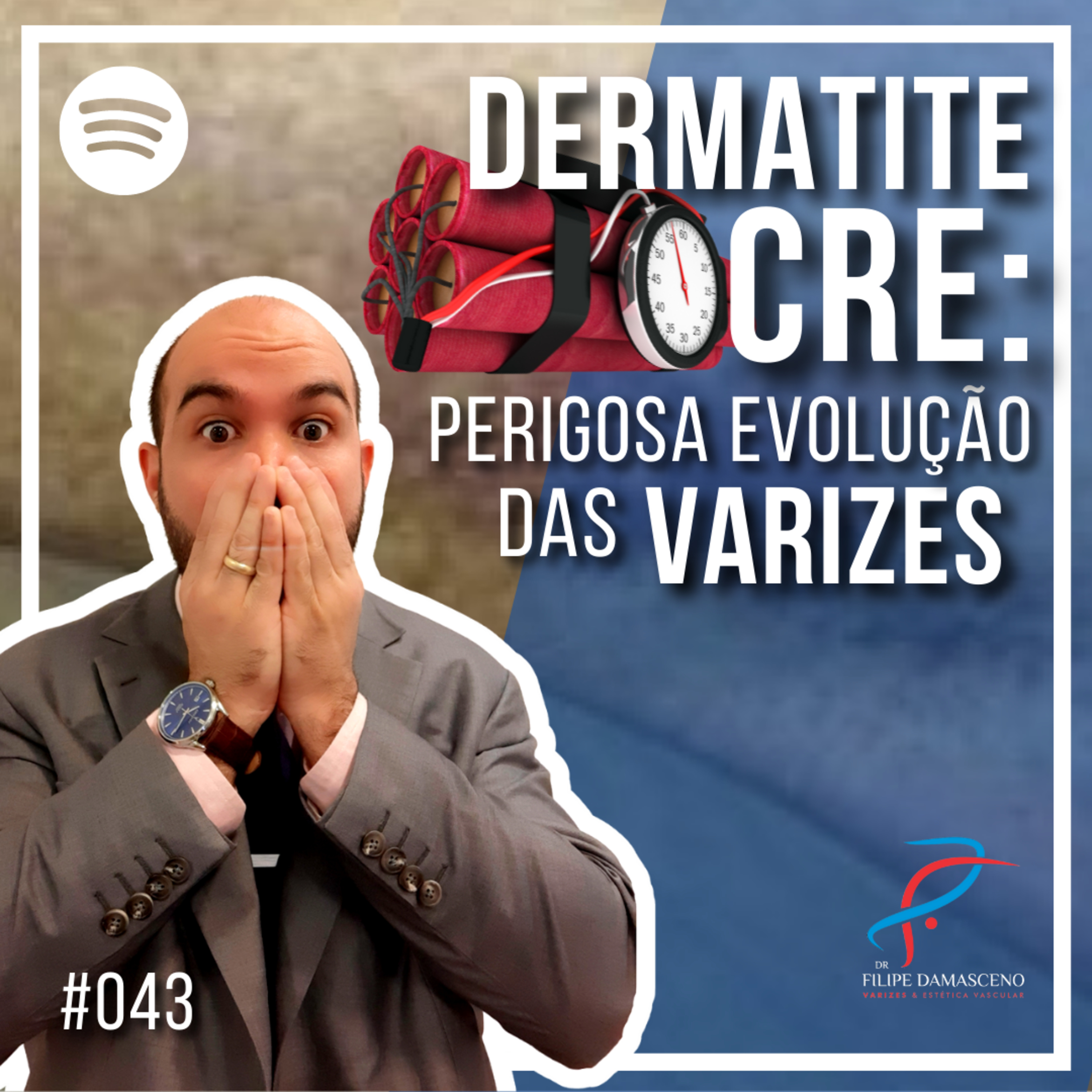 Filipe Damasceno | Vida sem Varizes