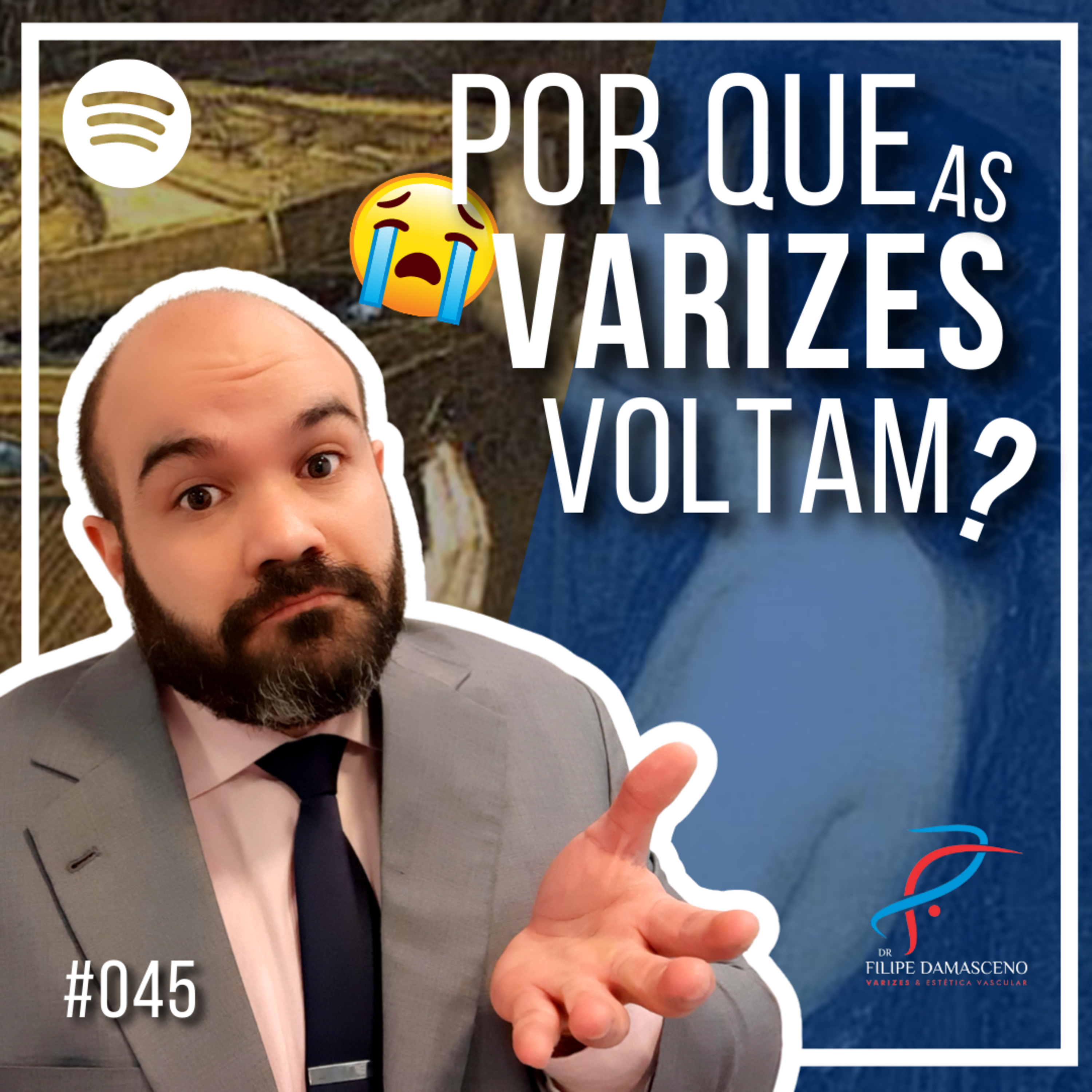 Filipe Damasceno | Vida sem Varizes