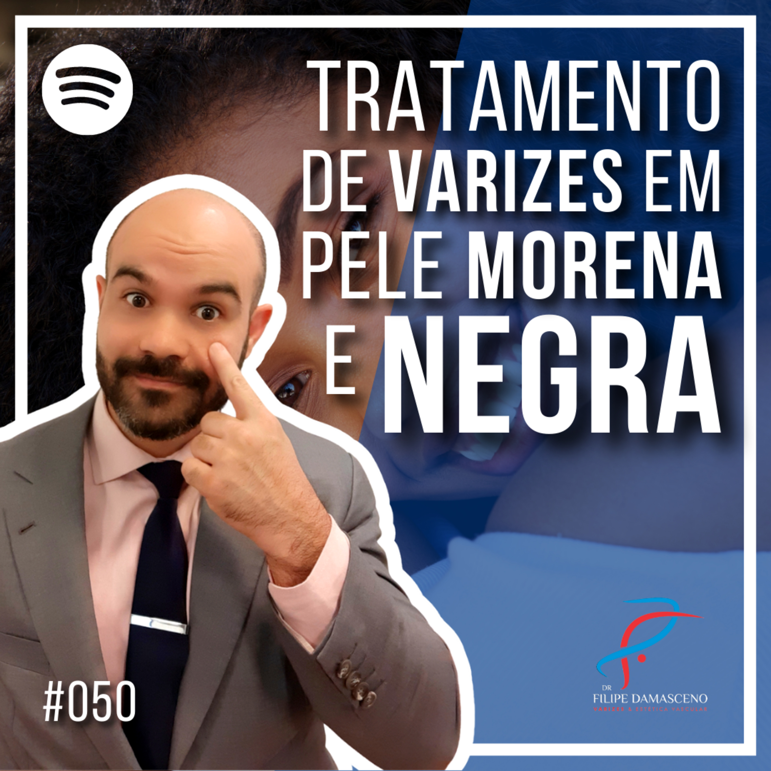 Filipe Damasceno | Vida sem Varizes