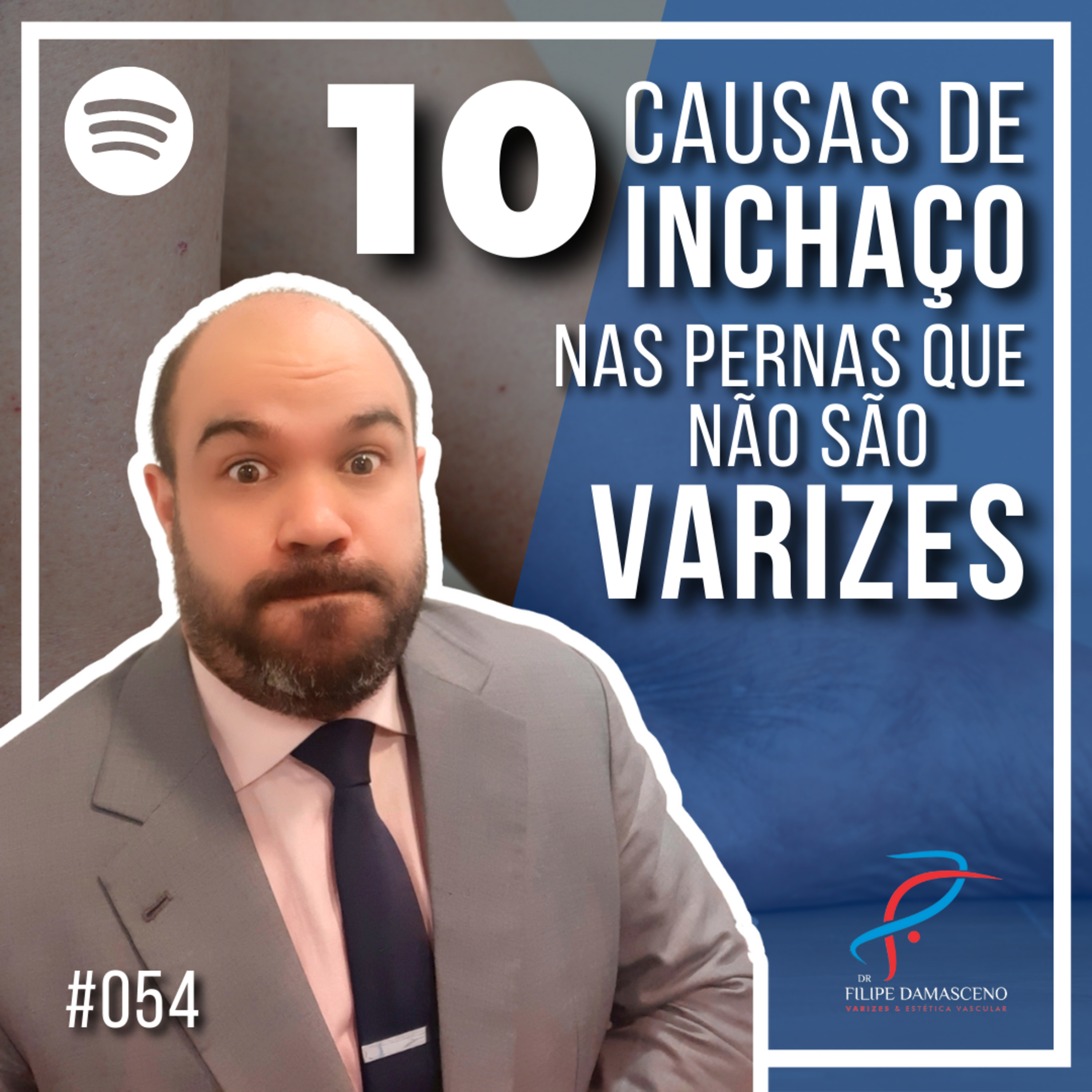 Filipe Damasceno | Vida sem Varizes