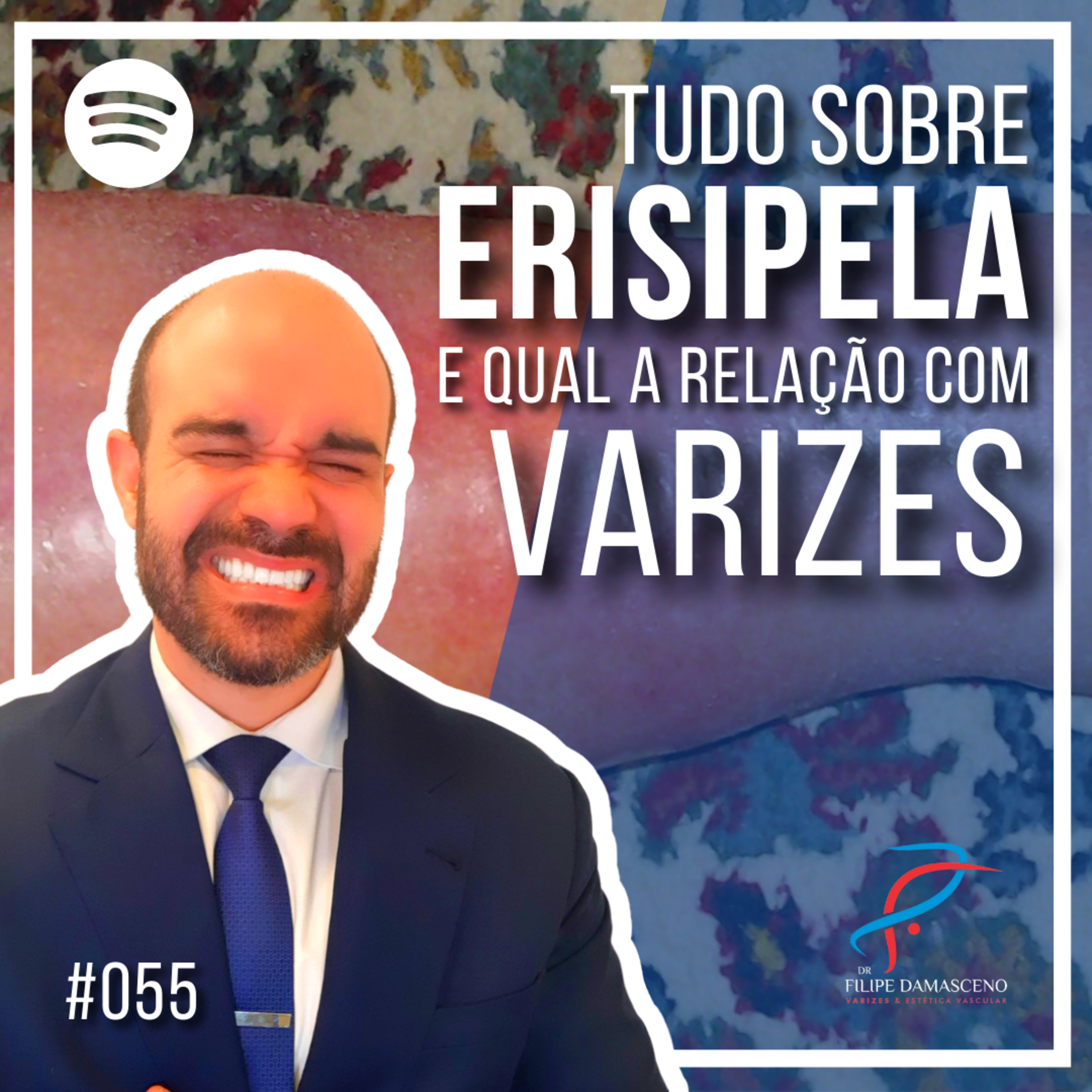 Filipe Damasceno | Vida sem Varizes