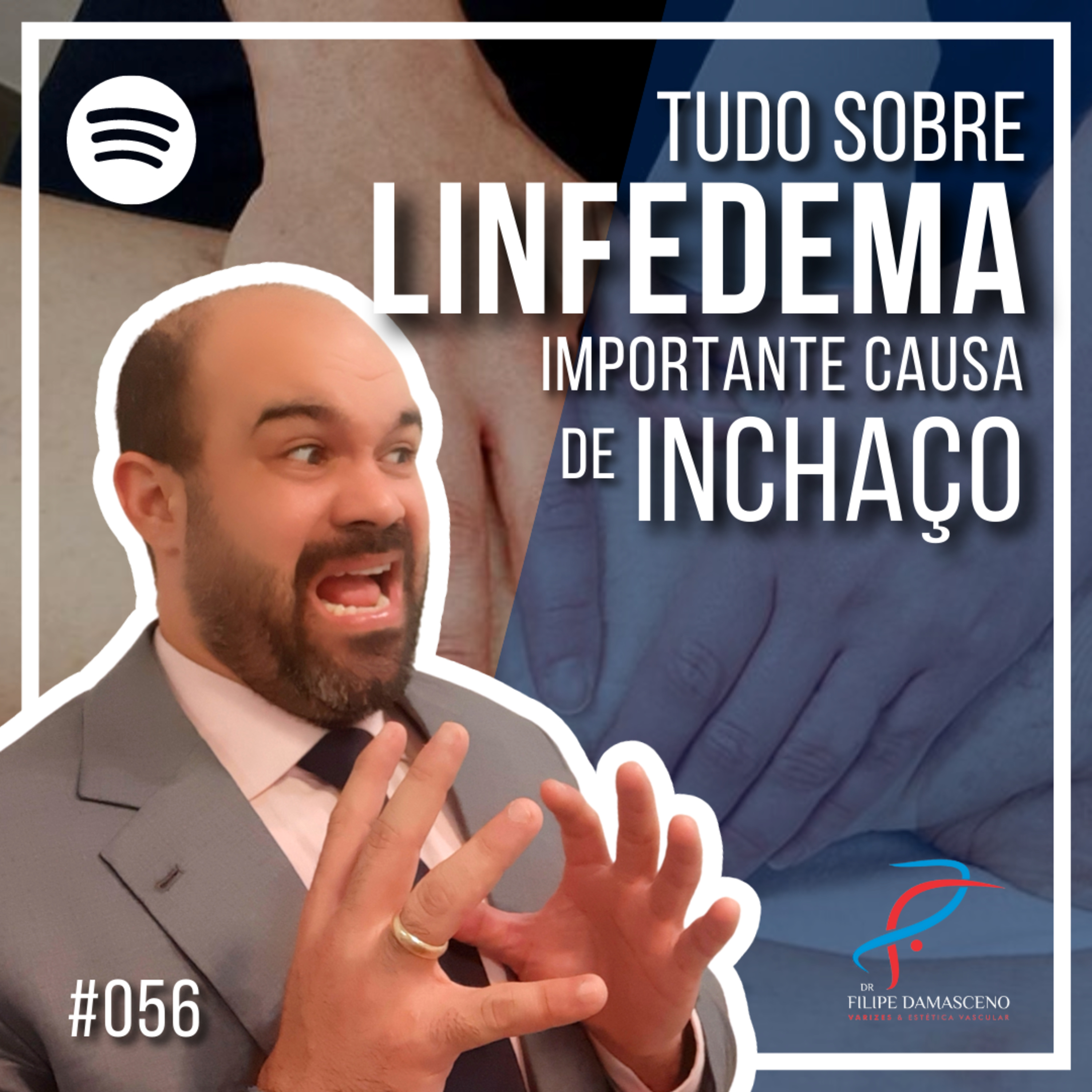 Filipe Damasceno | Vida sem Varizes